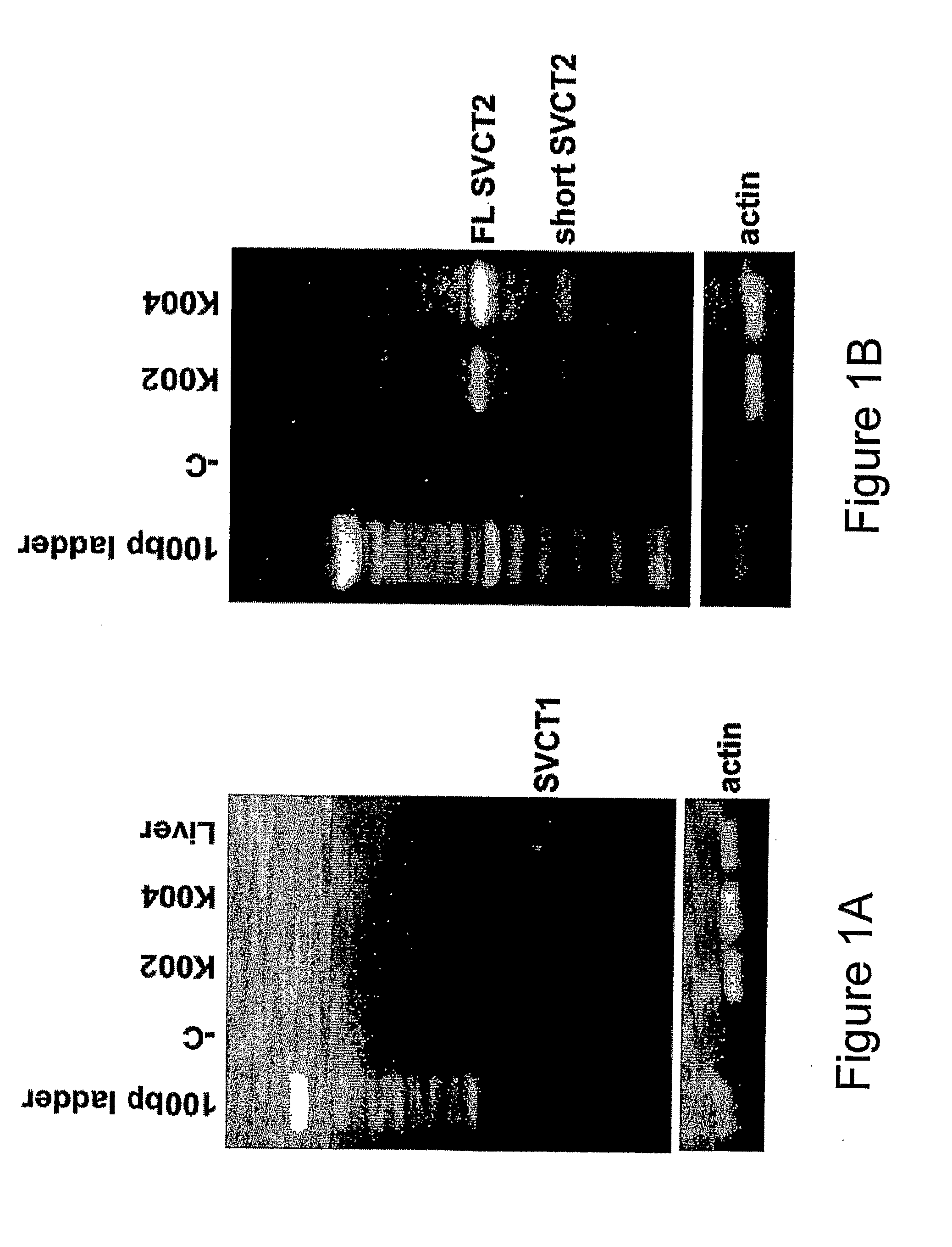 Facilitated Transport of Bisphosphonates by Vitamin C