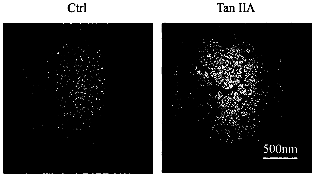Application of tanshinone IIA in inhibiting abnormal accumulation of Tau protein