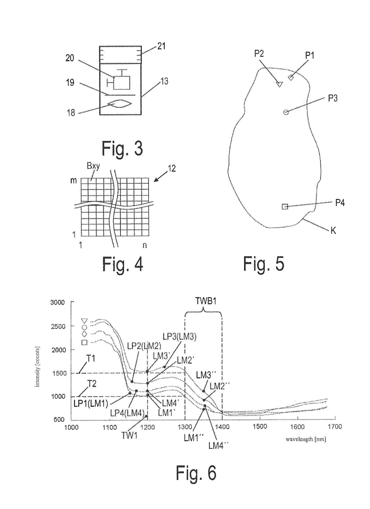 Method, sensor unit and machine for detecting “sugar top” defects in potatoes