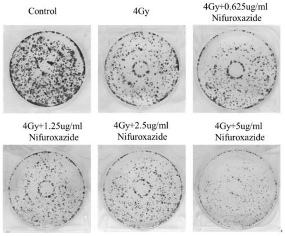 Application of Nifuroxazide in preparation of medicine for treating hepatocellular carcinoma