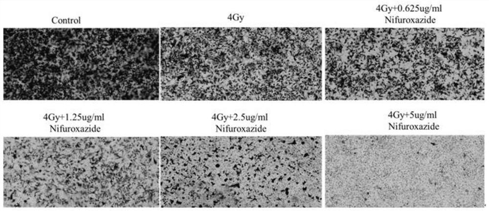 Application of Nifuroxazide in preparation of medicine for treating hepatocellular carcinoma