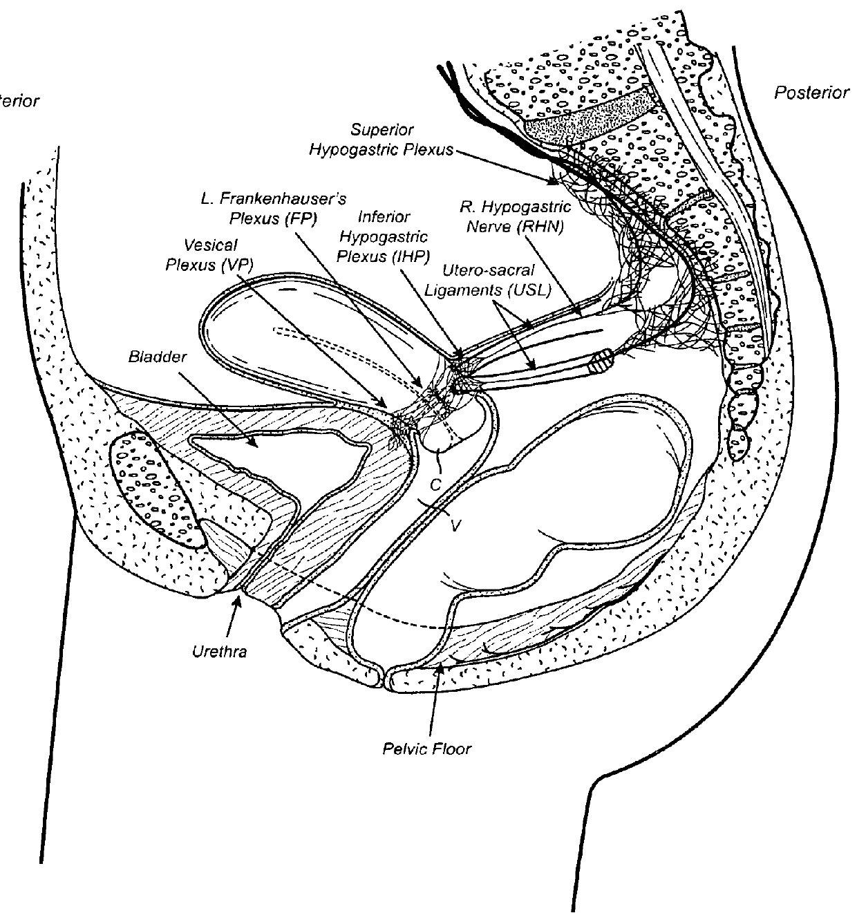 Devices and methods for stimulating nerves