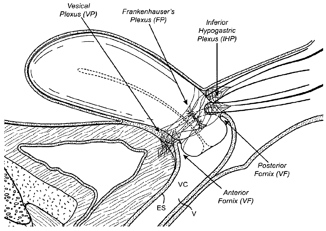 Devices and methods for stimulating nerves