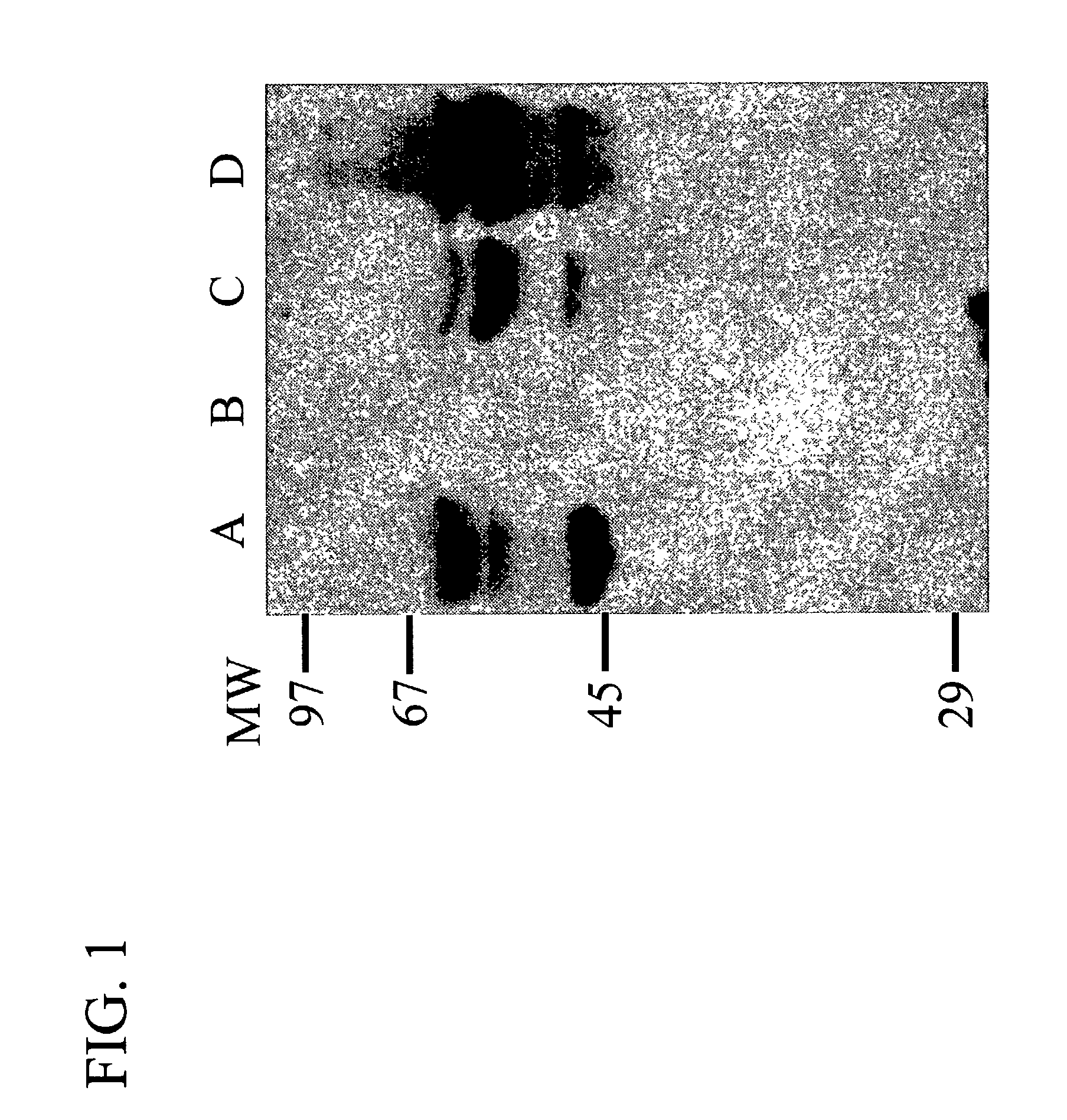 Methods for treating breast cancer using a mammary cell growth inhibitor