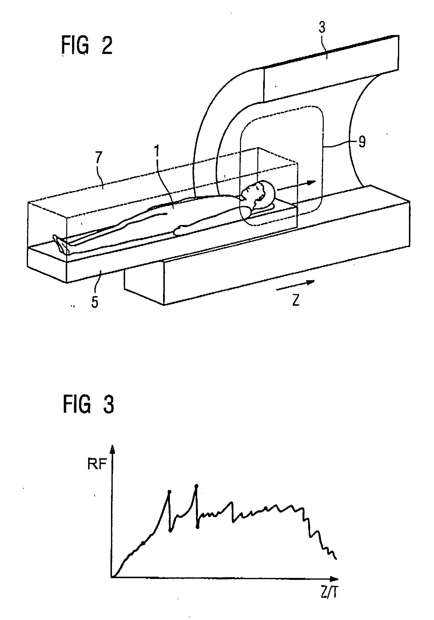 Method for implementation of a magnetic resonance examination of a patient