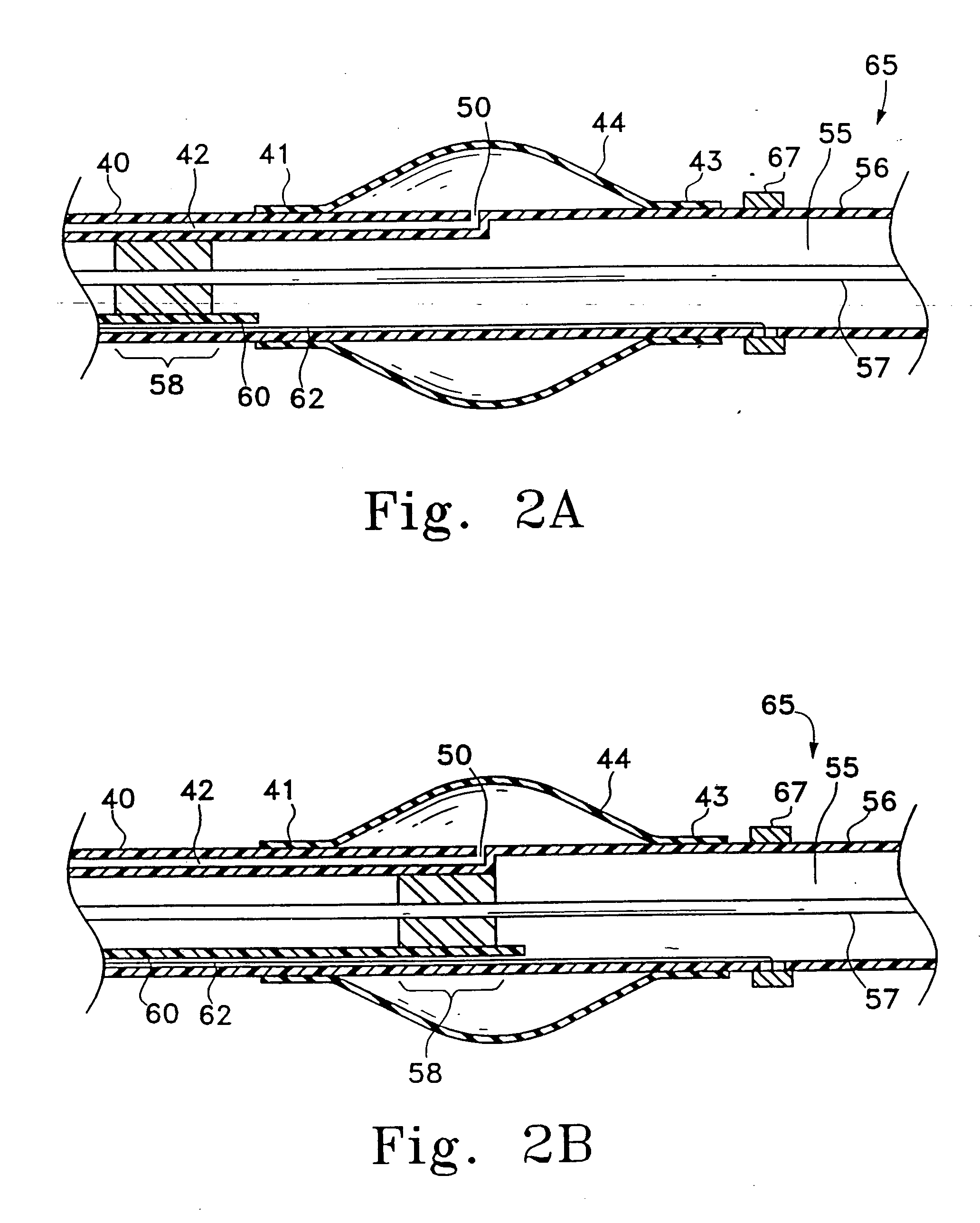 Manipulatable delivery catheter for occlusive devices (II)