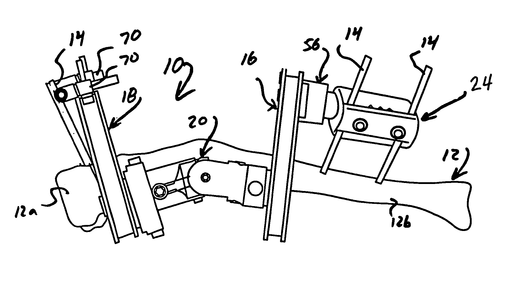 Frame assembly for external fixation device and associated method