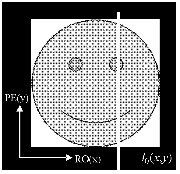 Method and system for correcting image distortion and magnetic resonance imaging device