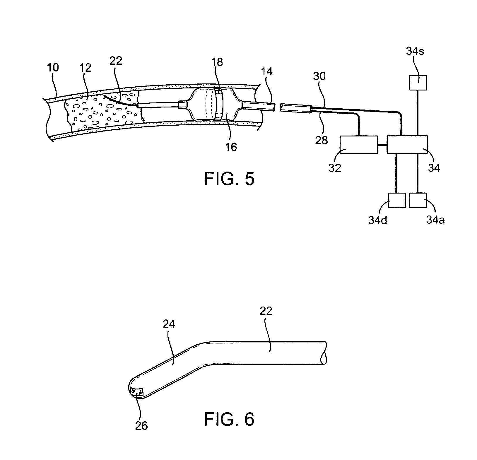 Intraluminal guidance system using bioelectric impedance