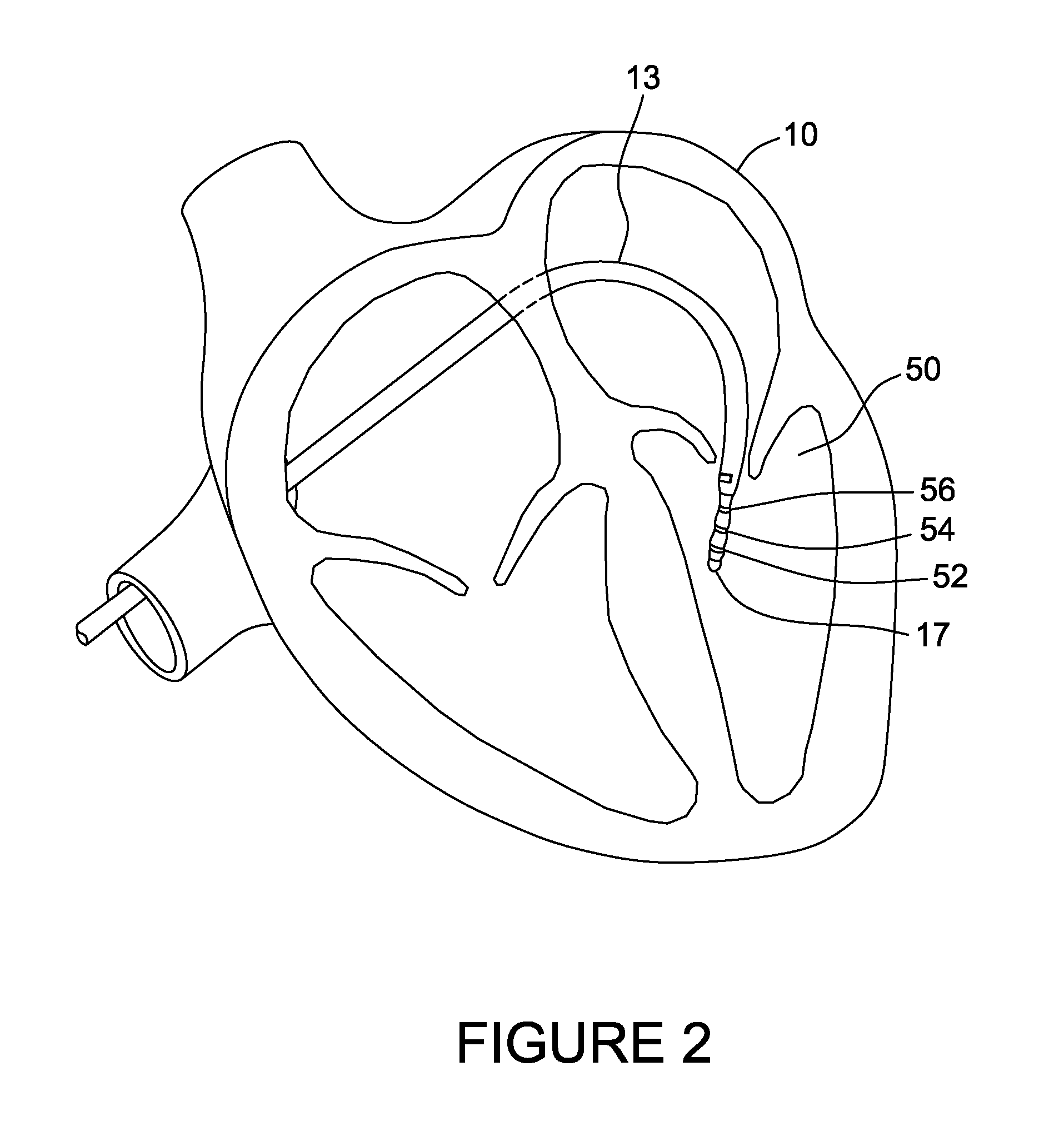 Cardiac Mapping System And Method For Bi-Directional Activation Detection Of Electrograms