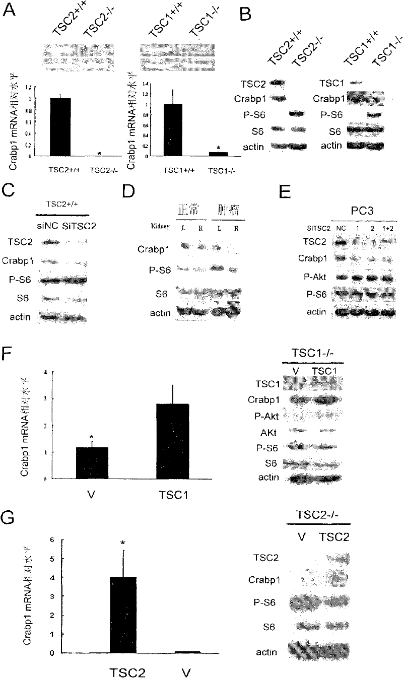Retinoic acid and its analogs are used to treat tumors caused by tsc1/tsc2 inactivation or activation of its upstream pathway