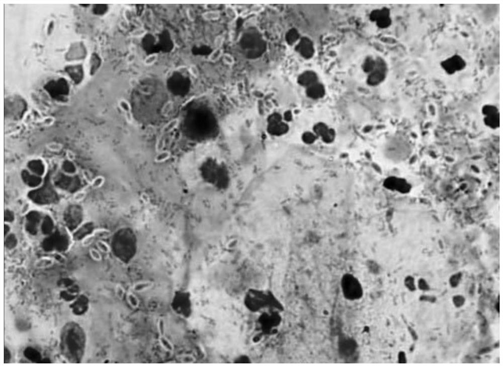 A kind of cell preservation solution for liquid-based cell inspection and its preparation method