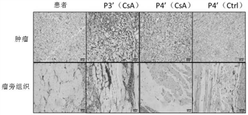 Construction and application of immunocompetent synovial sarcoma xenograft mouse model