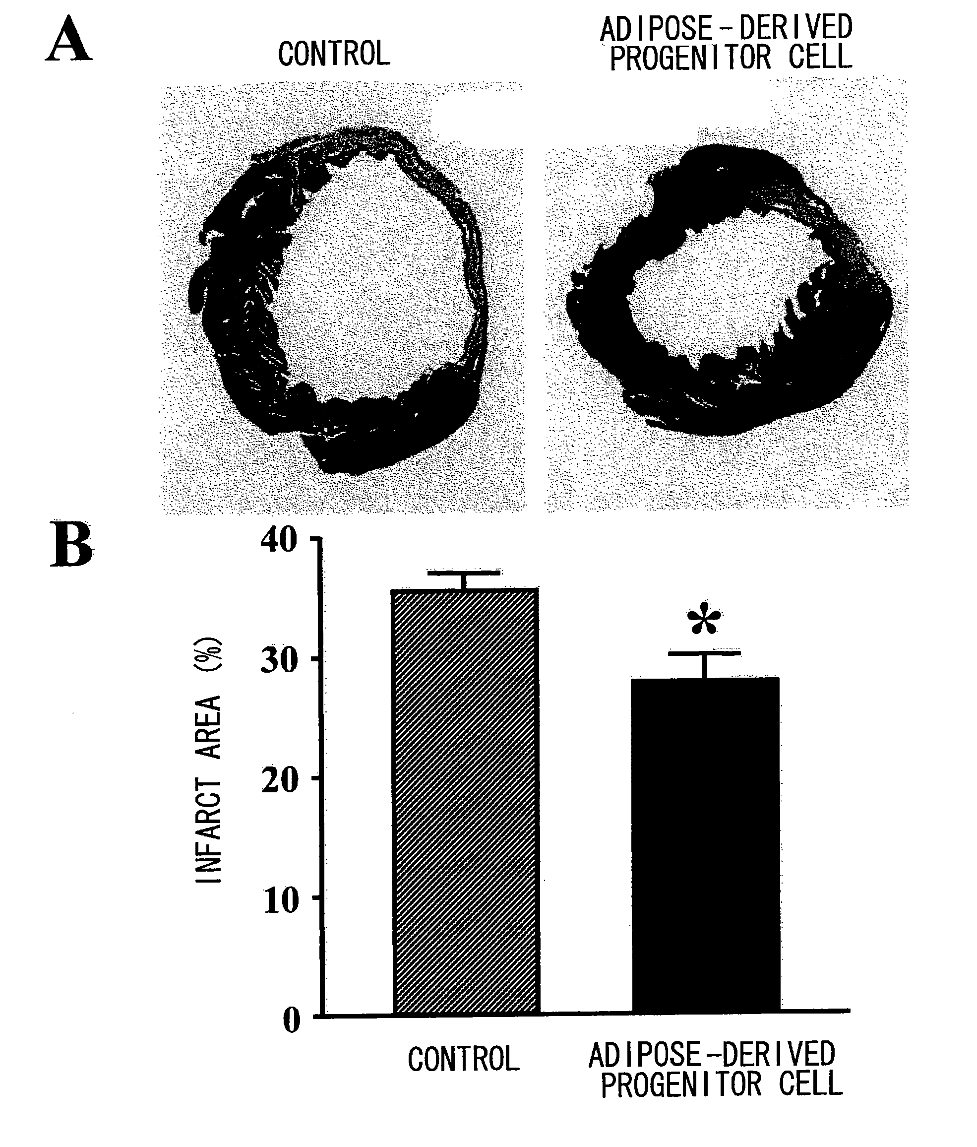 Fat-Derived Progenitor Cell and Use Thereof