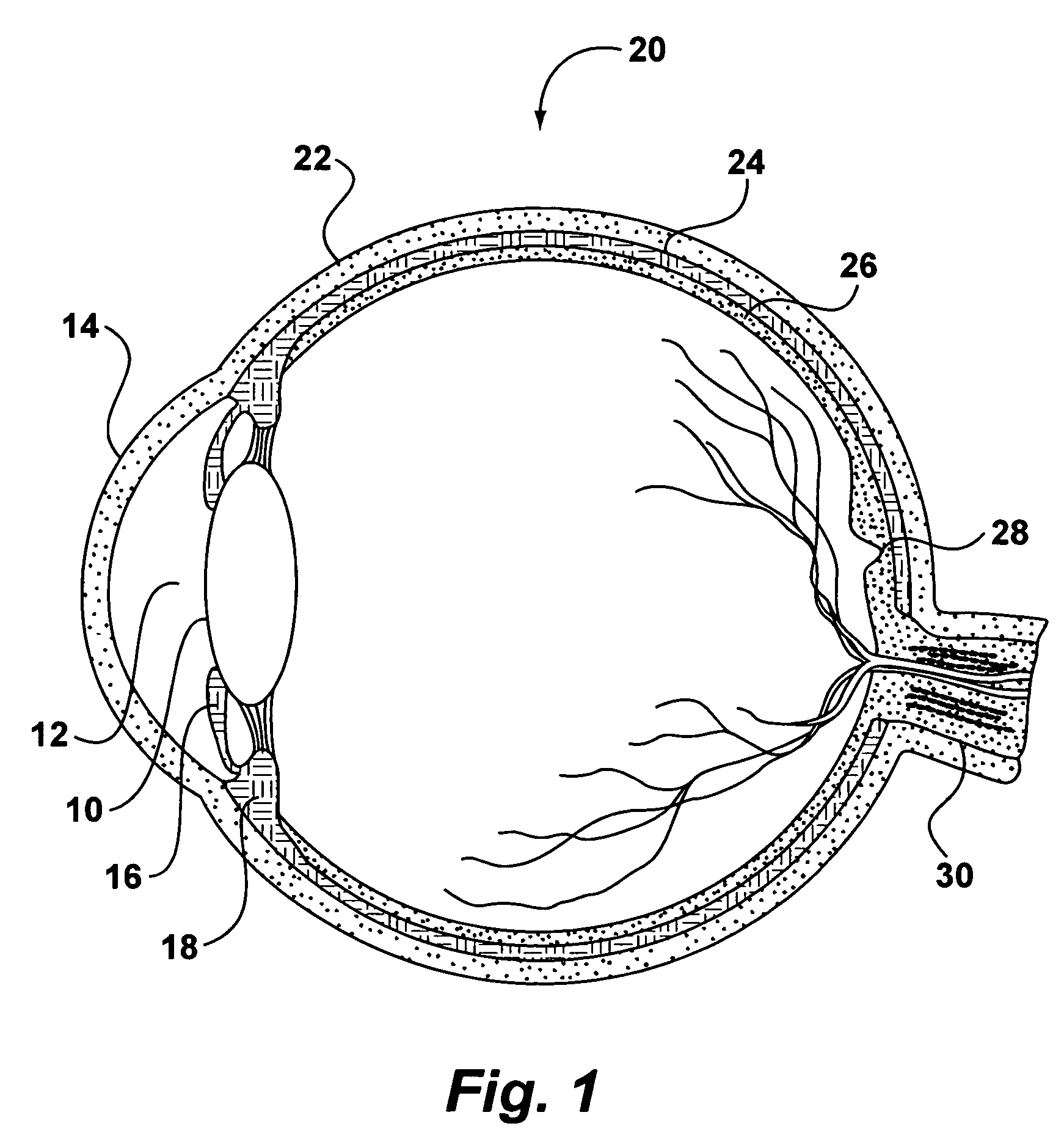 System and method for storing, shipping and injecting ocular devices