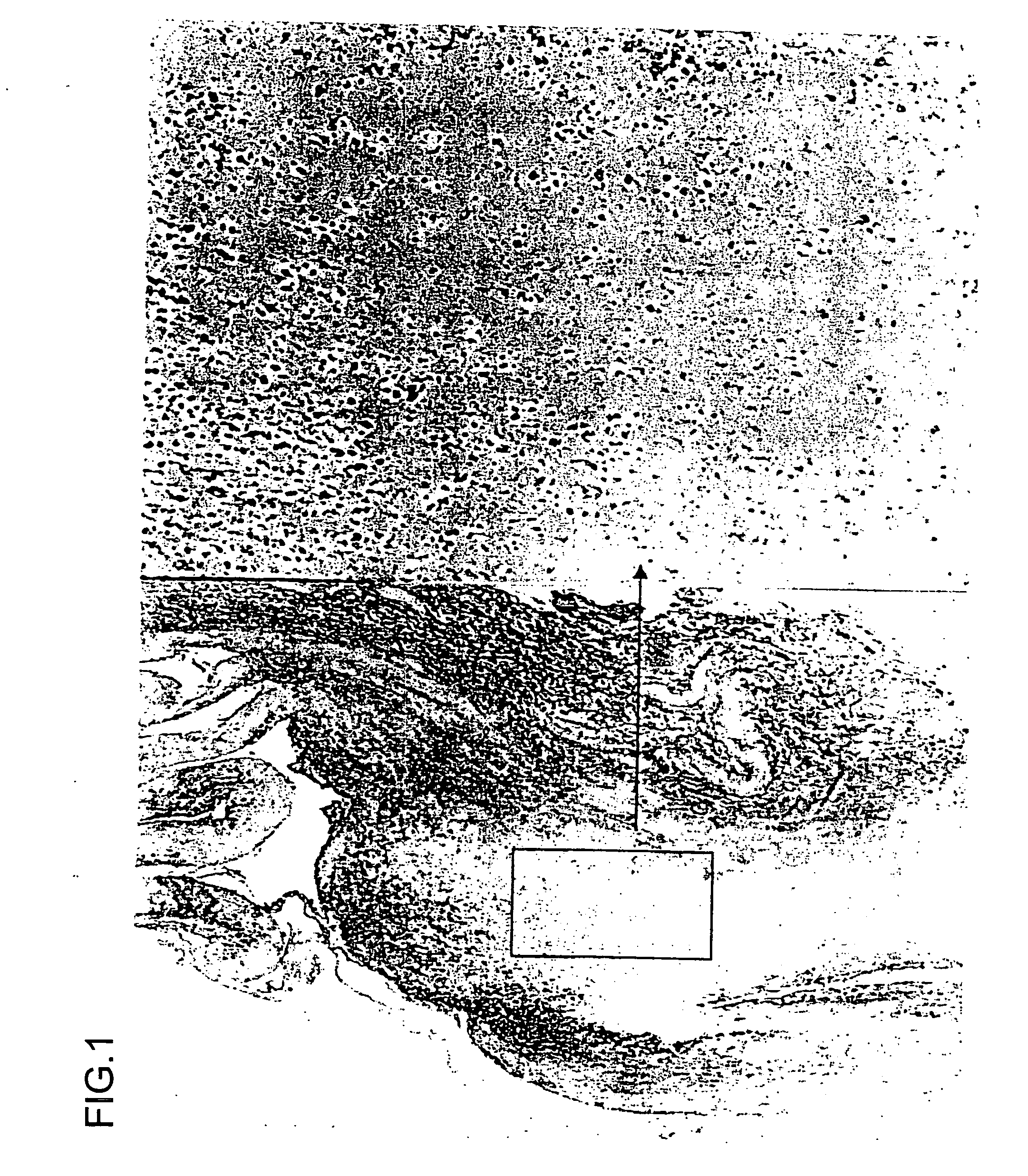 Pharmaceutical composition containing decoy and use of the same