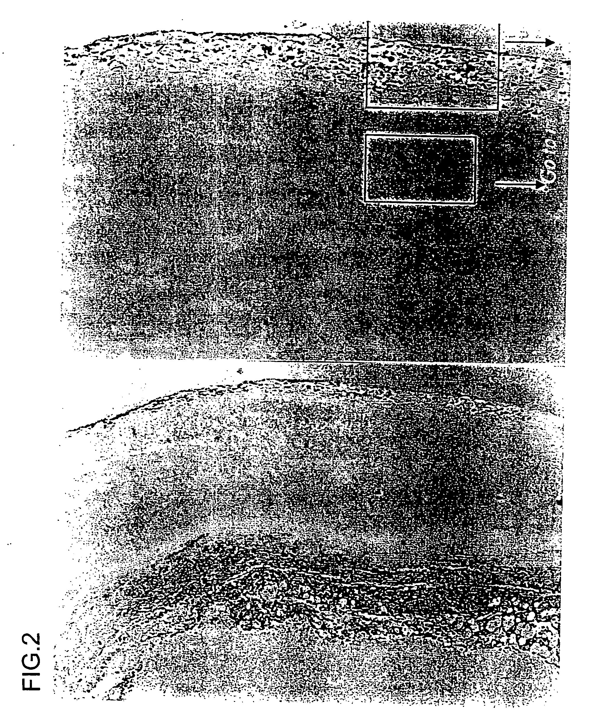 Pharmaceutical composition containing decoy and use of the same