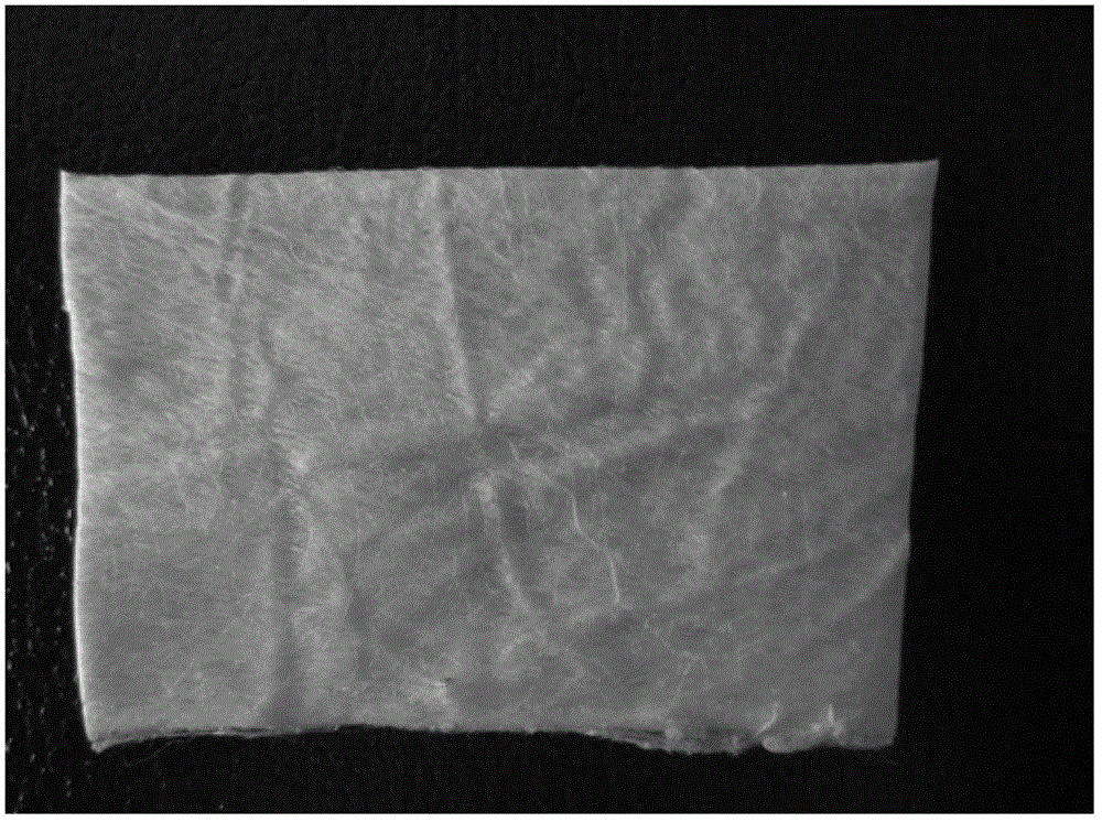 Method for preparing collagen/lactic acid-caprolactone copolymer composite fiber bracket