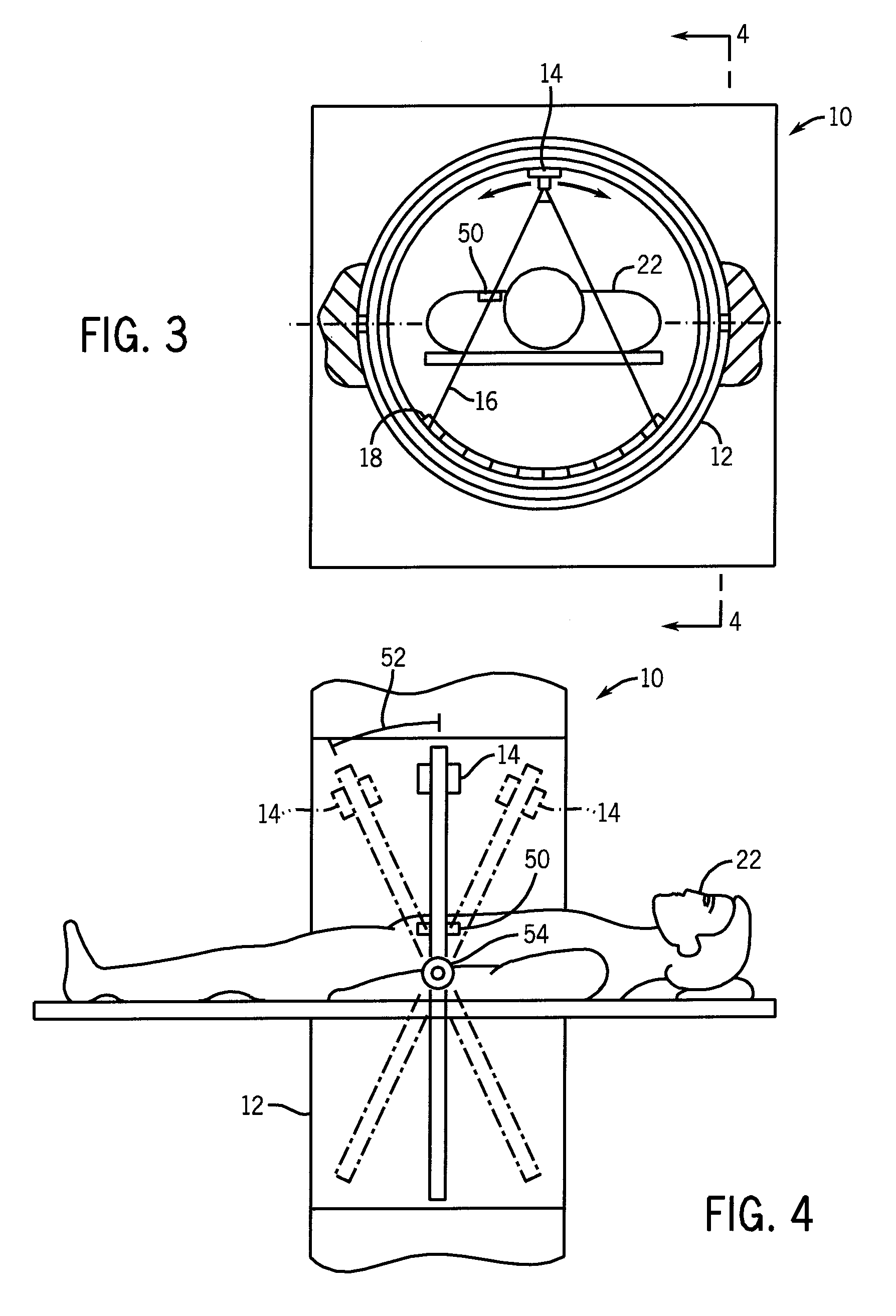 Method and apparatus for reduction of metal artifacts in ct imaging