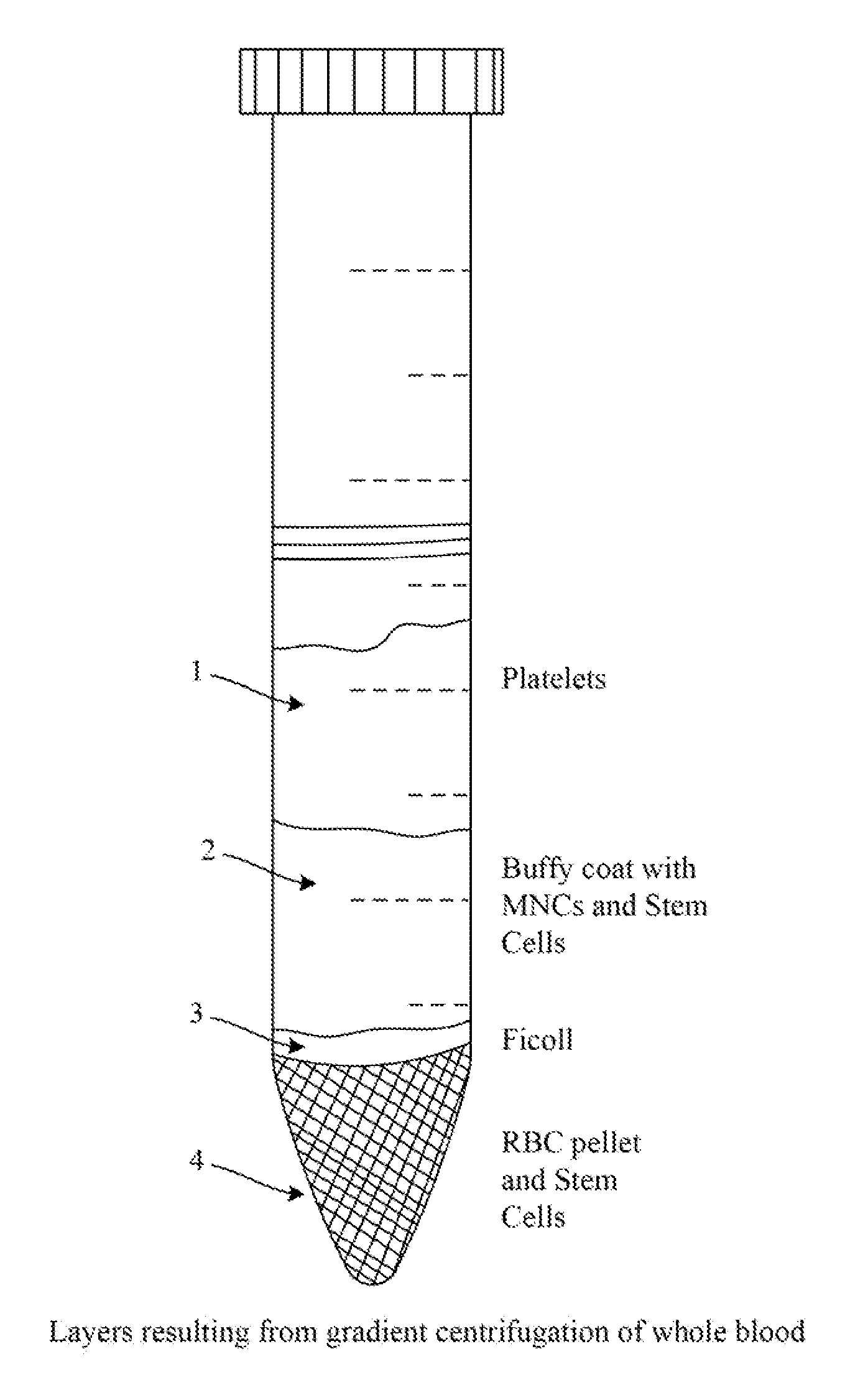 Personalized production of biologics and method for reprogramming somatic cells