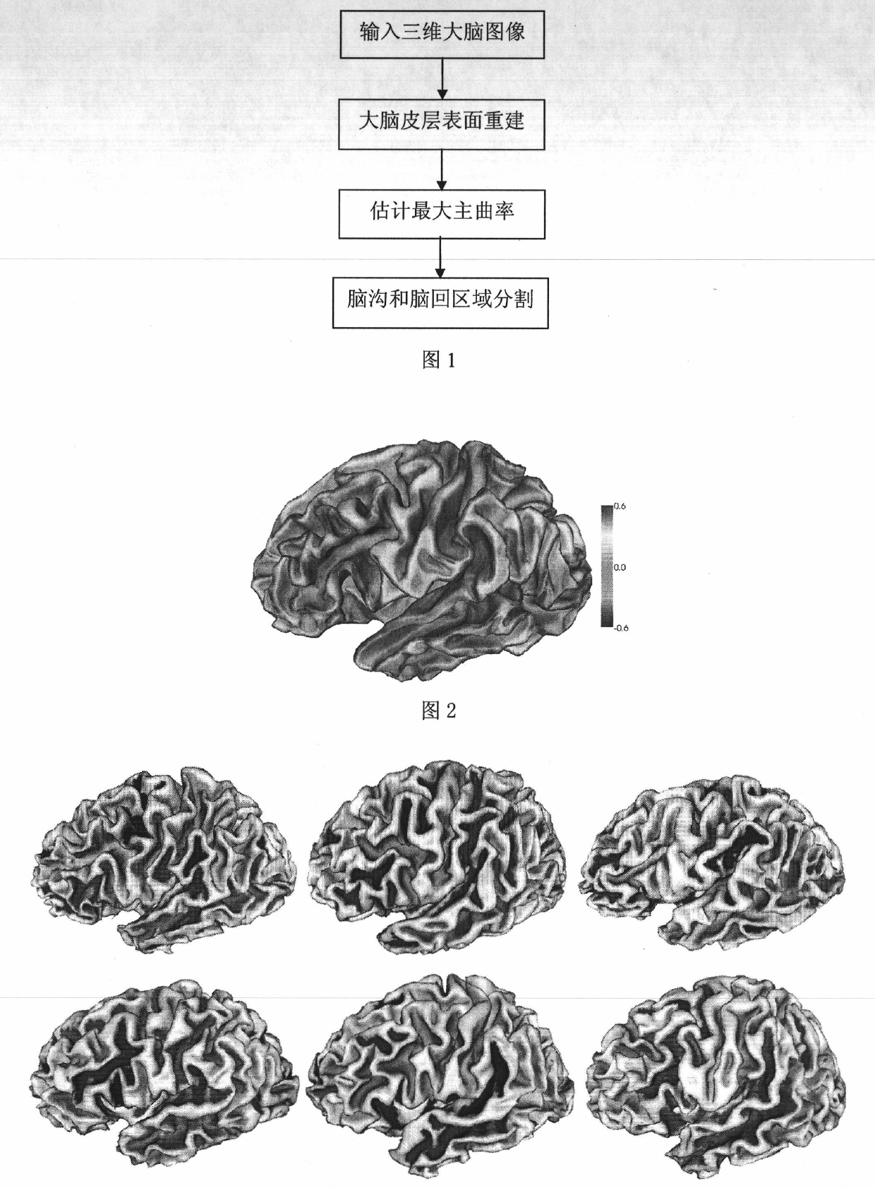 Method for segmenting sulus regions on surface of pallium of a three-dimensional cerebral magnetic resonance image