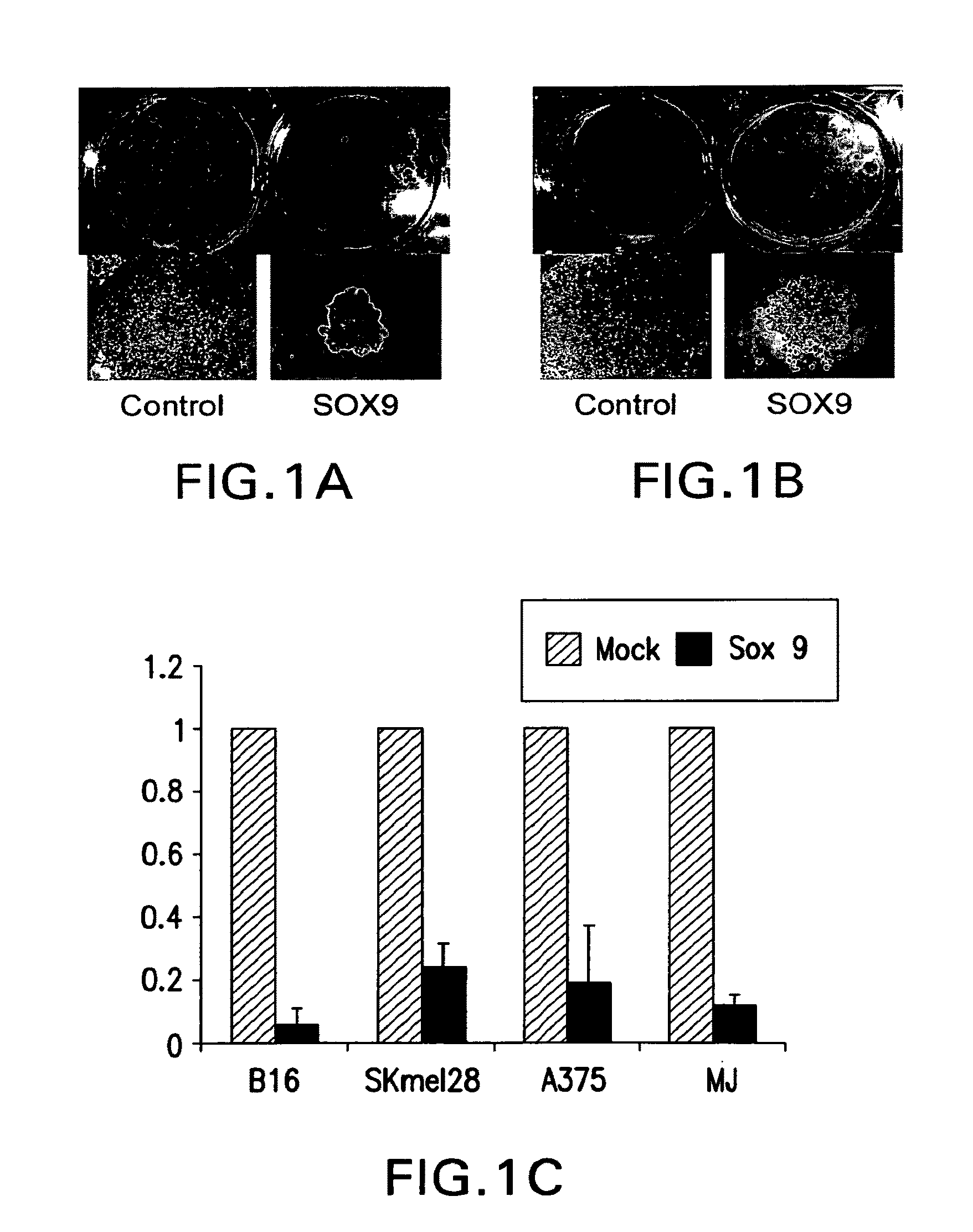 Compositions and Methods for Treating Pigmentary Conditions and Melanoma