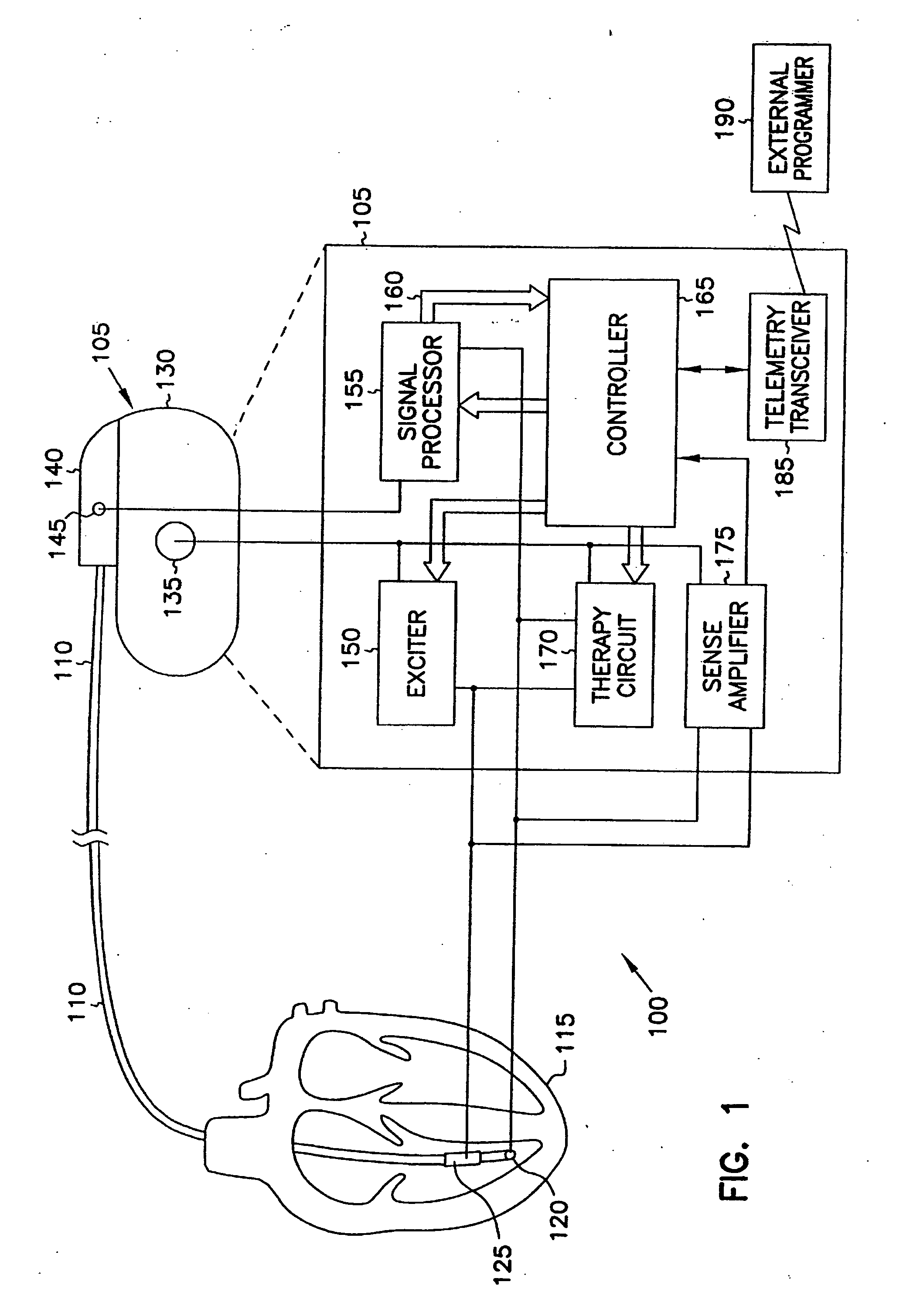 Systems and methods for hypotension