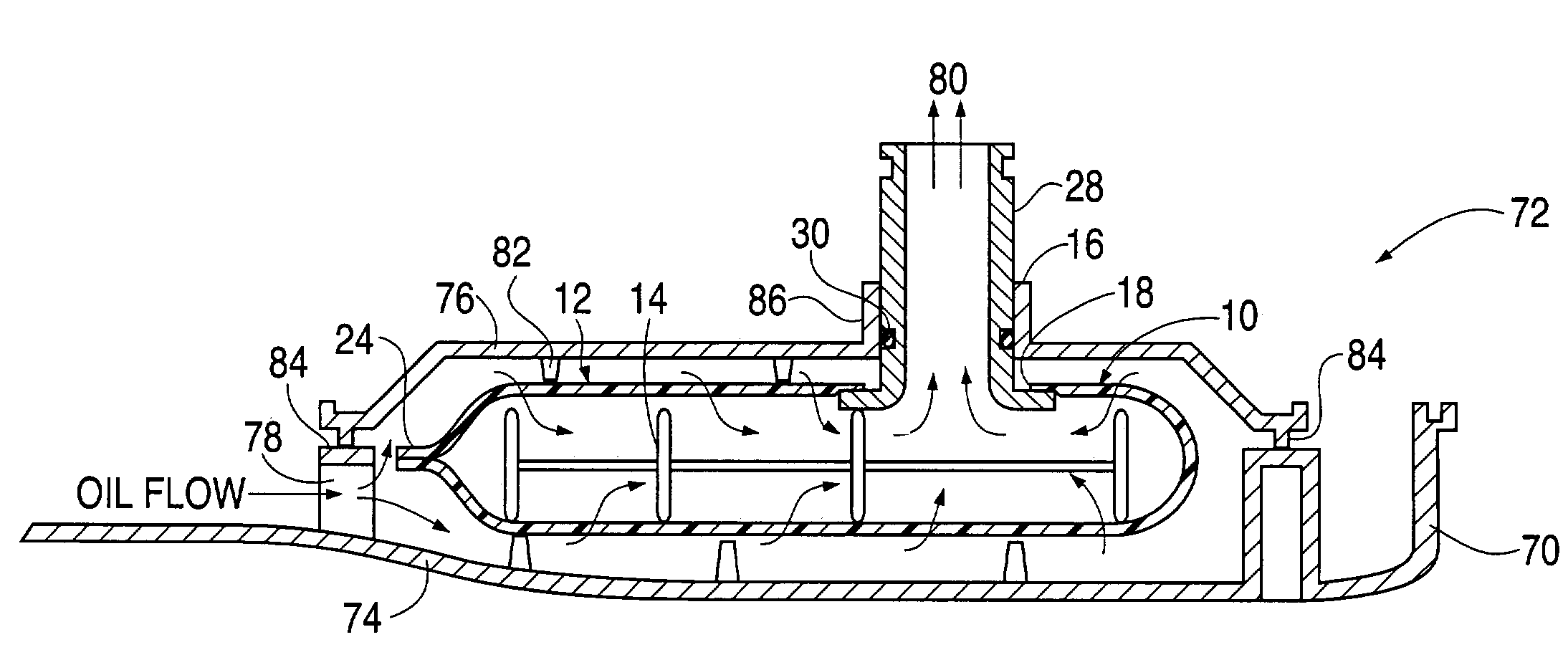 Outside-in flow engine and transmission filter and method