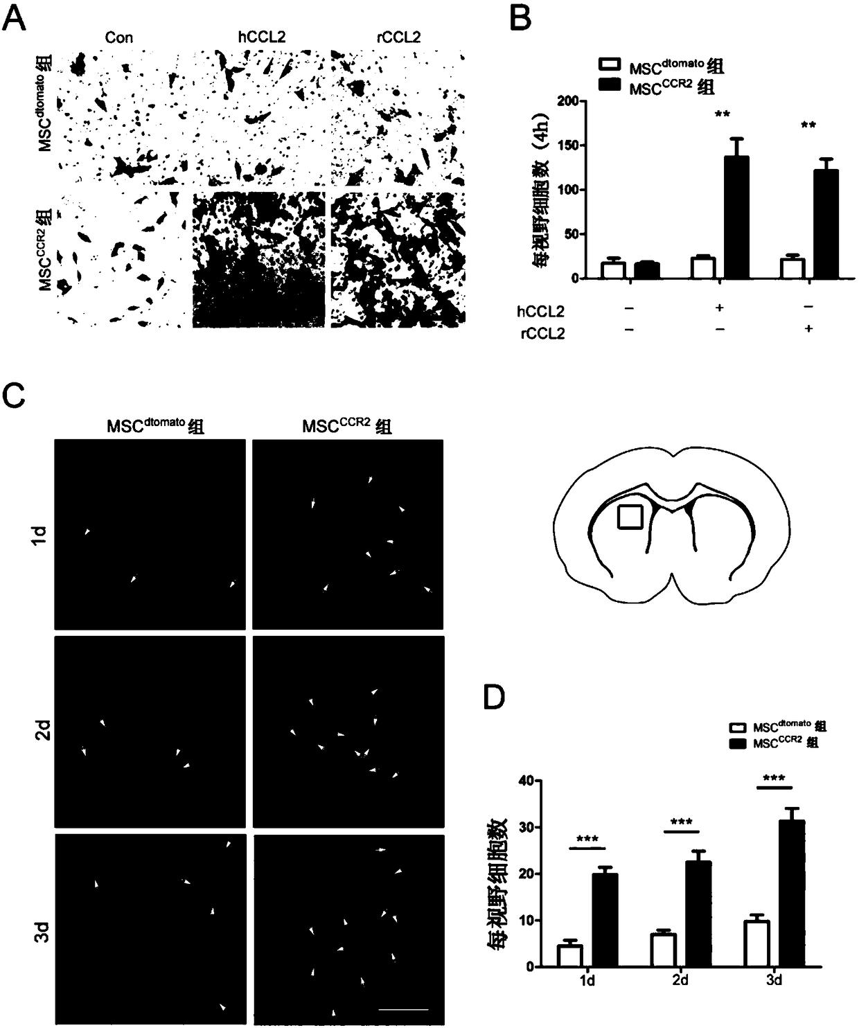 Mesenchymal stem cells overexpressing CCR2 for treating acute ischemic stroke and preparation method thereof