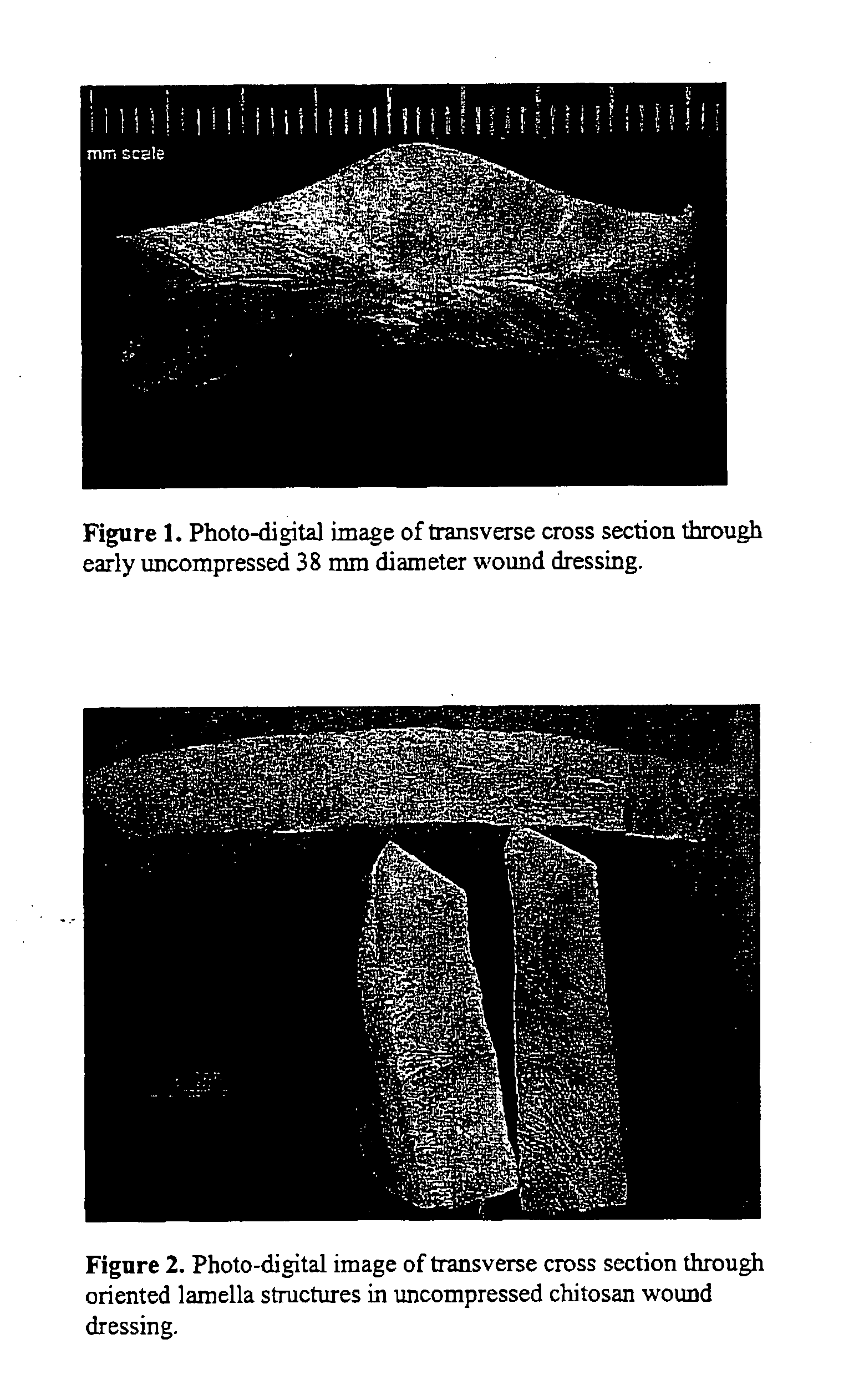 Wound dressings, apparatus, and methods for controlling severe, life-threatening bleeding