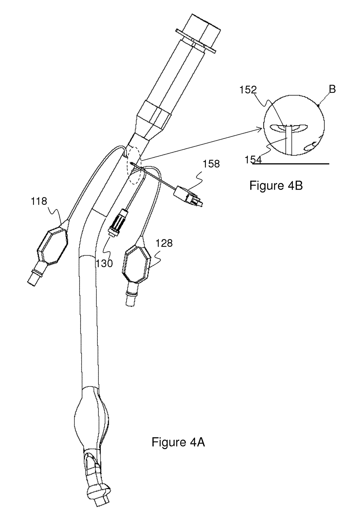 Endobronchial tube with integrated image sensor and a cleaning nozzle arrangement