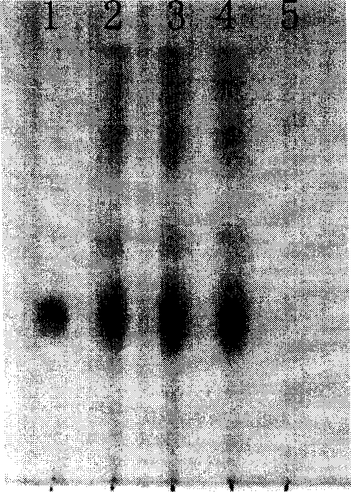 Quality control method of kidney beneficial bone fortifying capsule