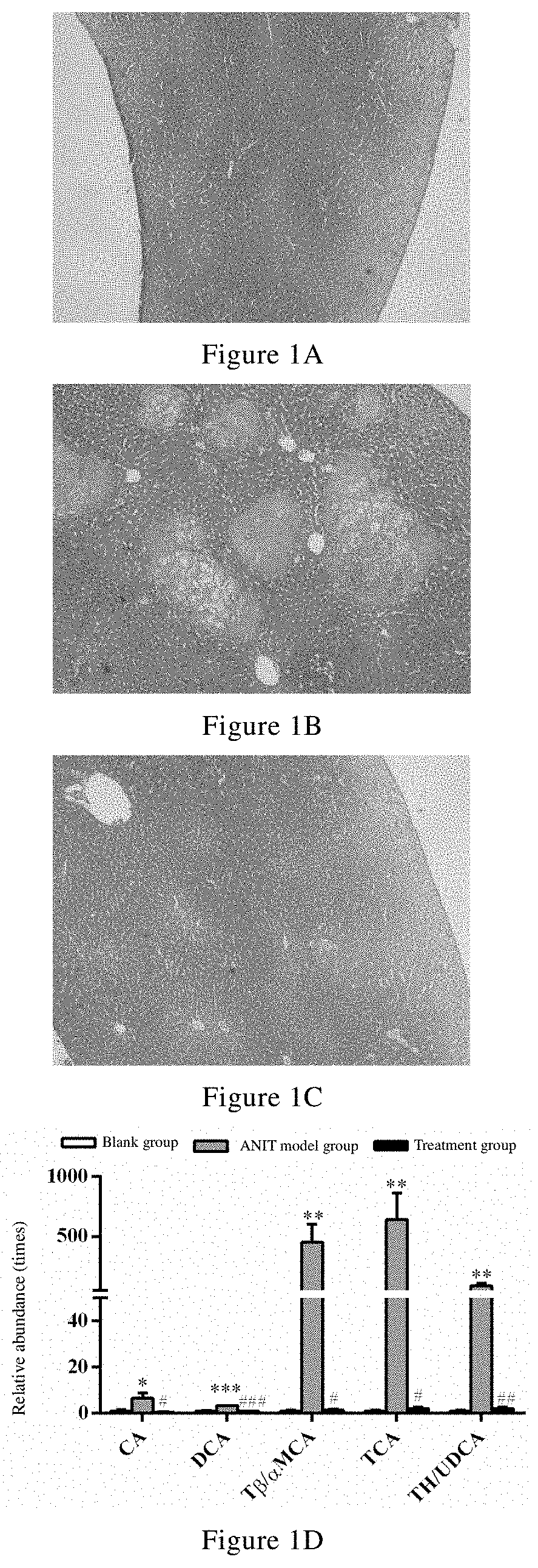 Uses of celastrol in preventing and/or treating cholestatic liver disease and liver fibrosis