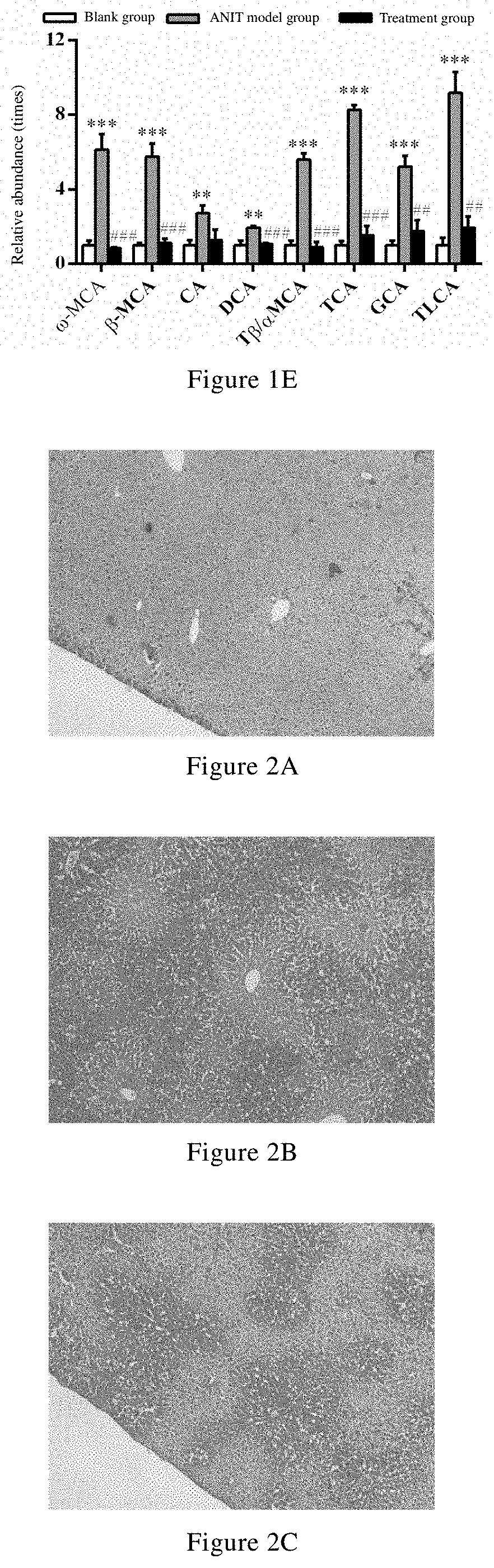 Uses of celastrol in preventing and/or treating cholestatic liver disease and liver fibrosis