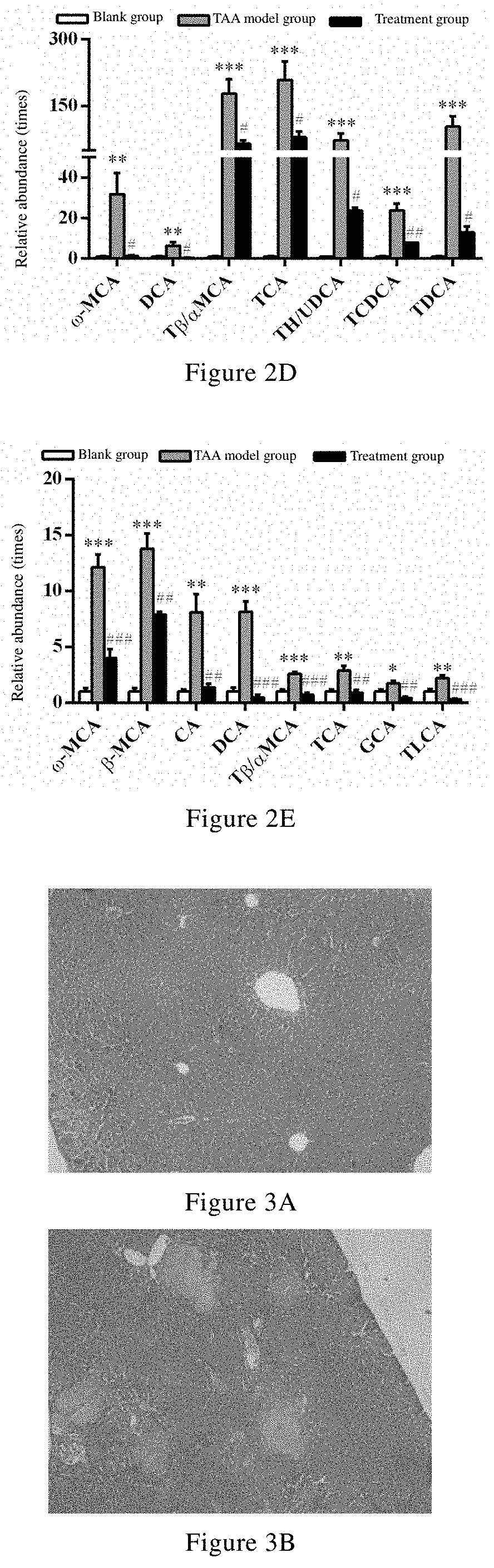 Uses of celastrol in preventing and/or treating cholestatic liver disease and liver fibrosis