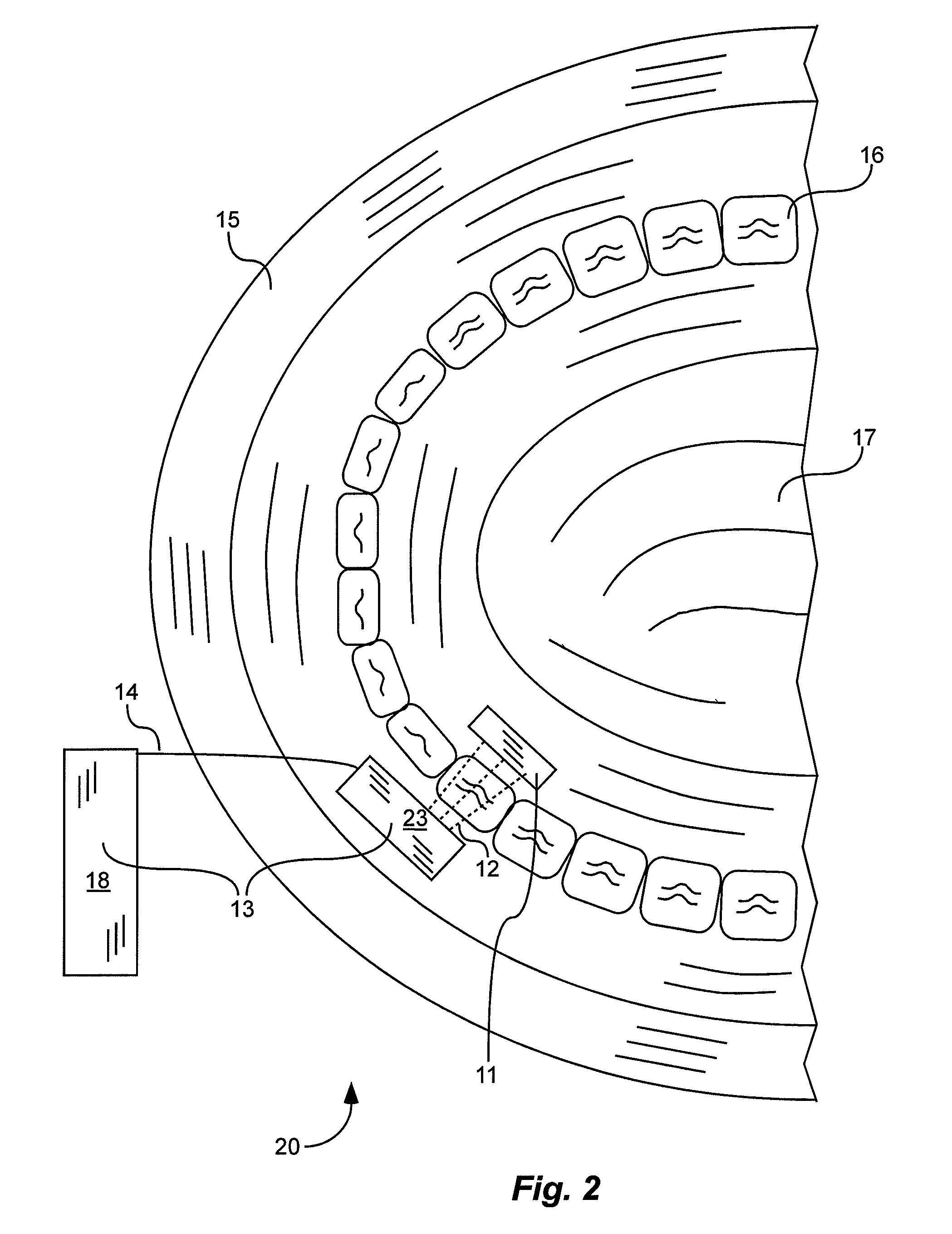 X-ray tube and receiver inside mouth