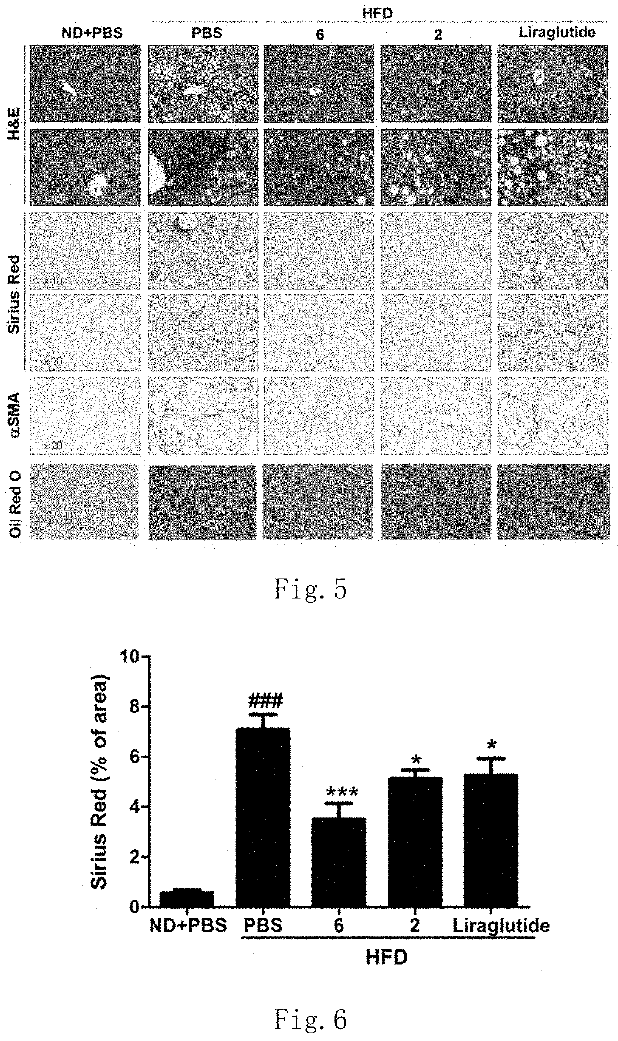 GLP-1R/GCGR dual target agonist polypeptide for treatment of fatty liver diseases, hyperlipemia and arteriosclerosis