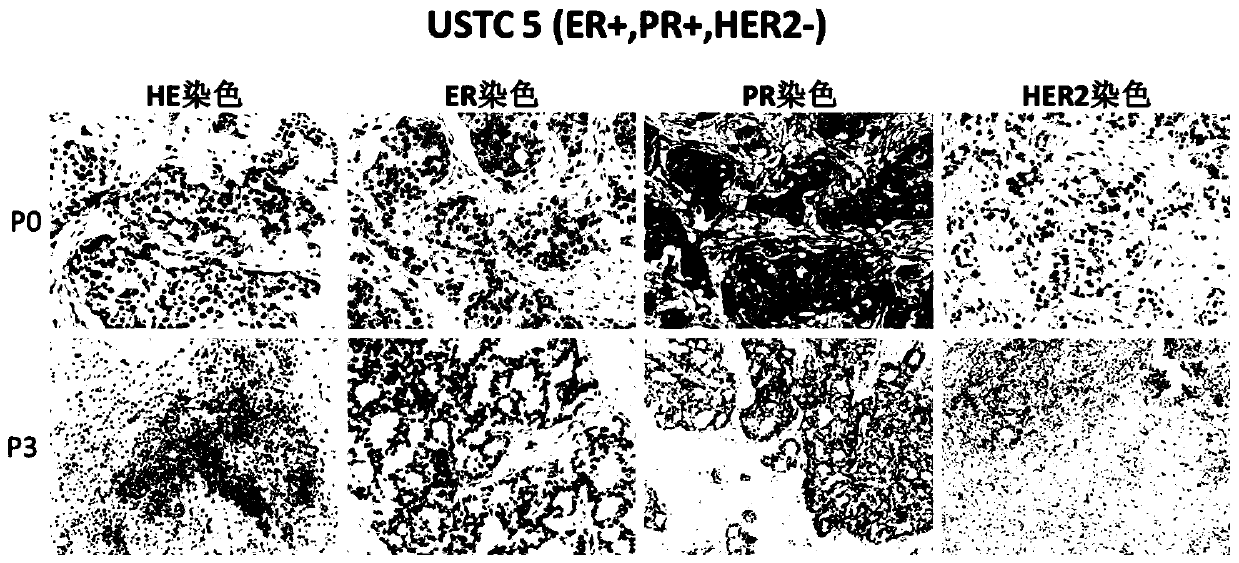 Construction method and application of xenograft tumor models derived from different subtypes of Chinese breast cancer patients