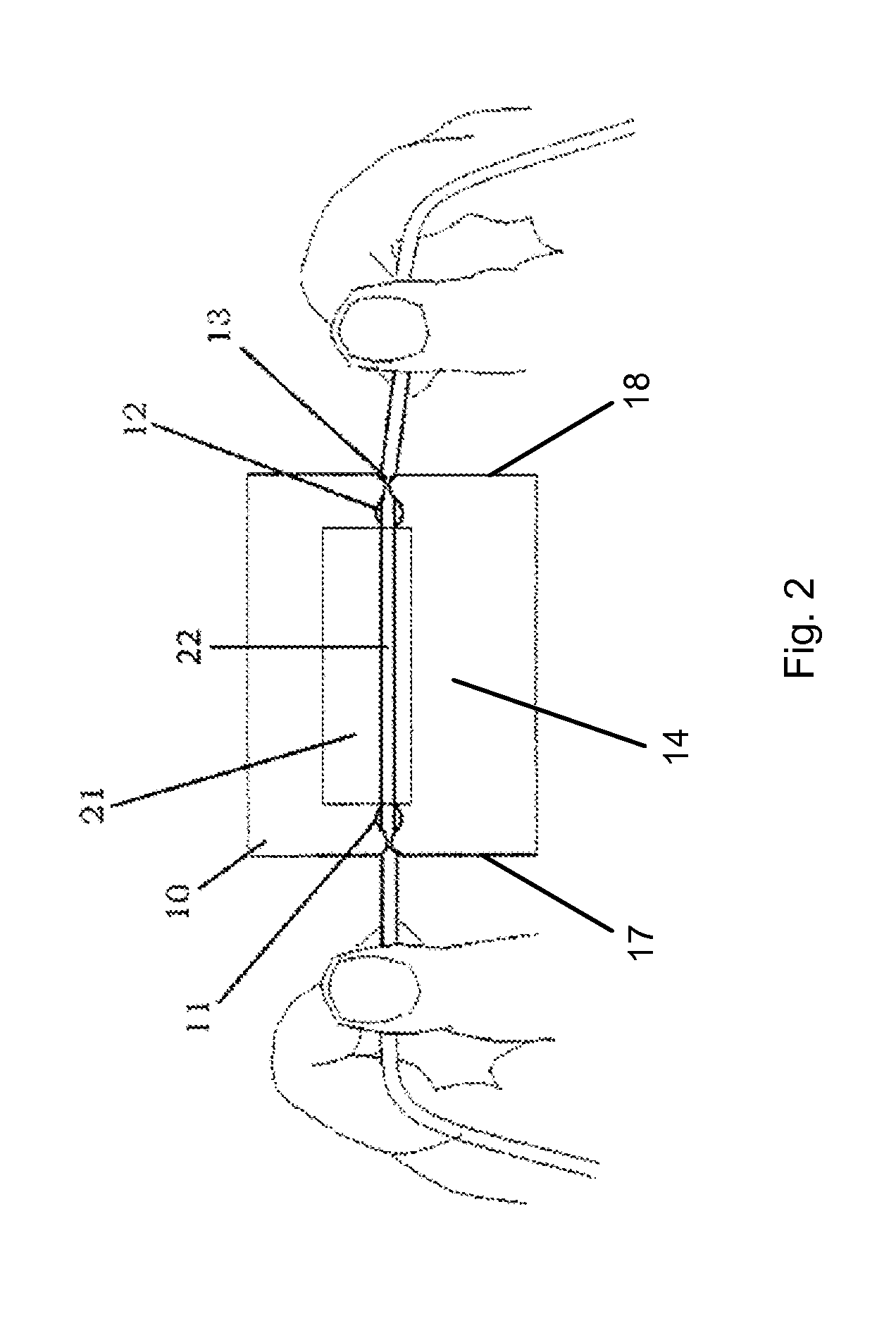 Multiple intravenous line organizer and method for using thereof
