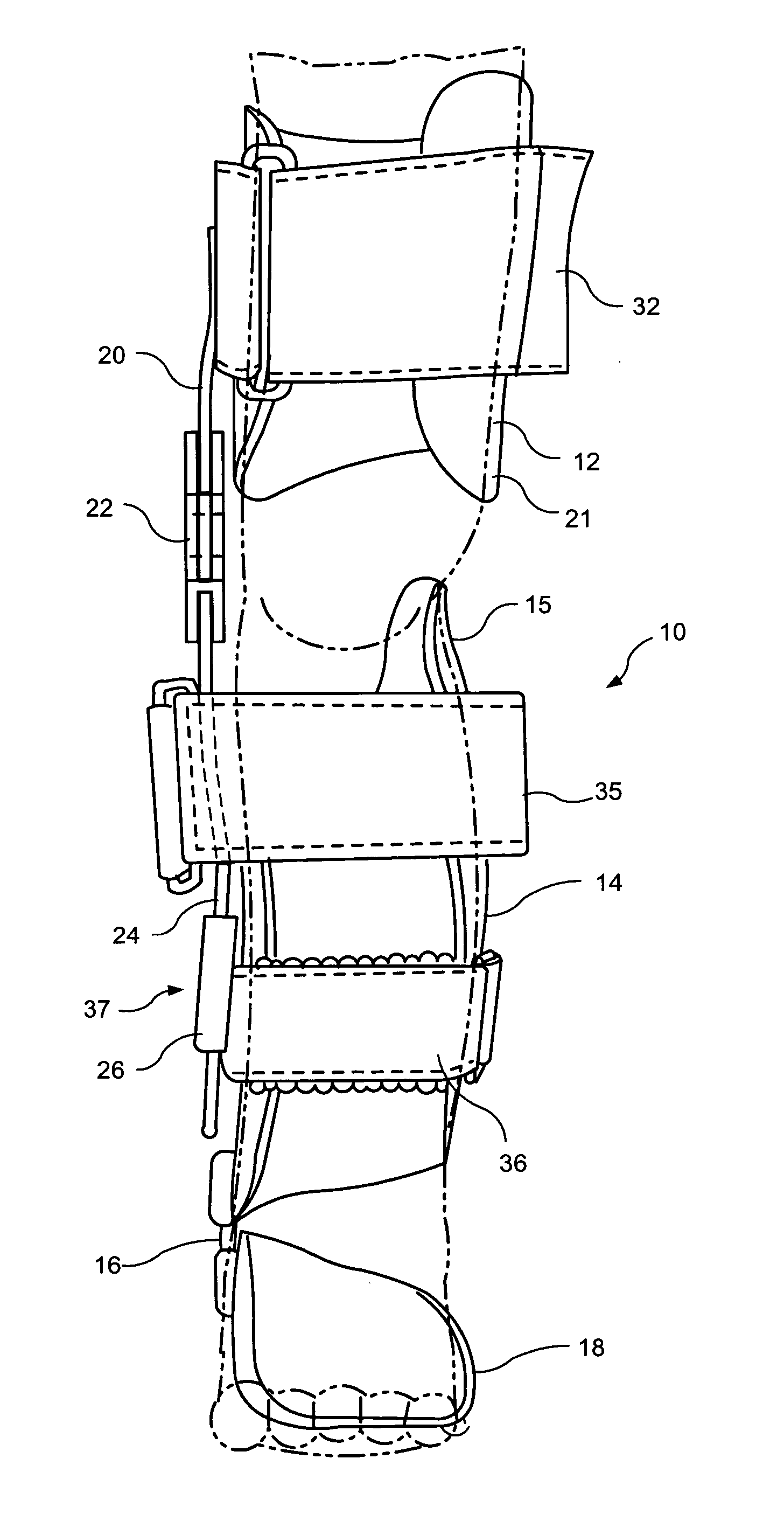 Apparatus for correction of leg deformities