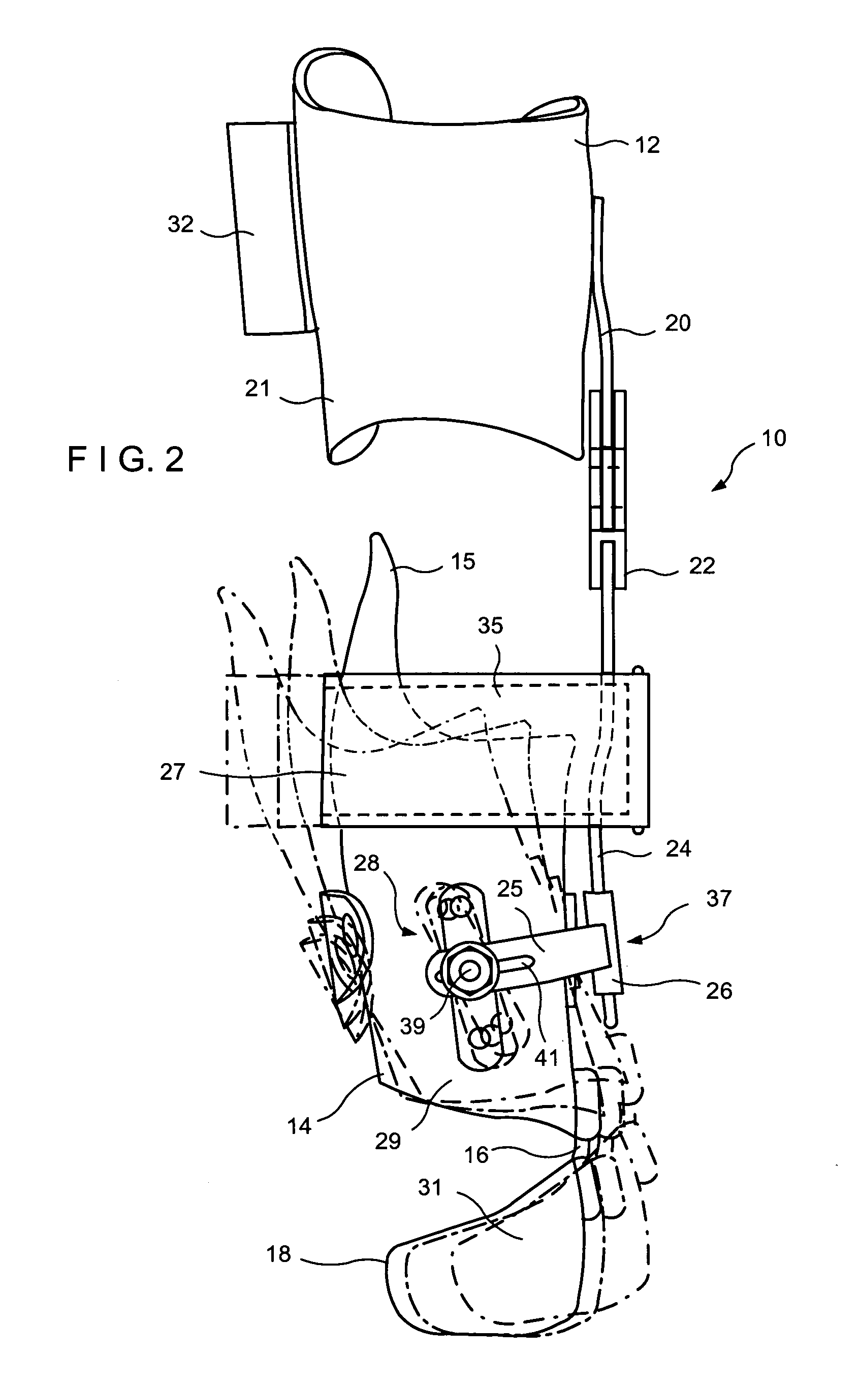 Apparatus for correction of leg deformities