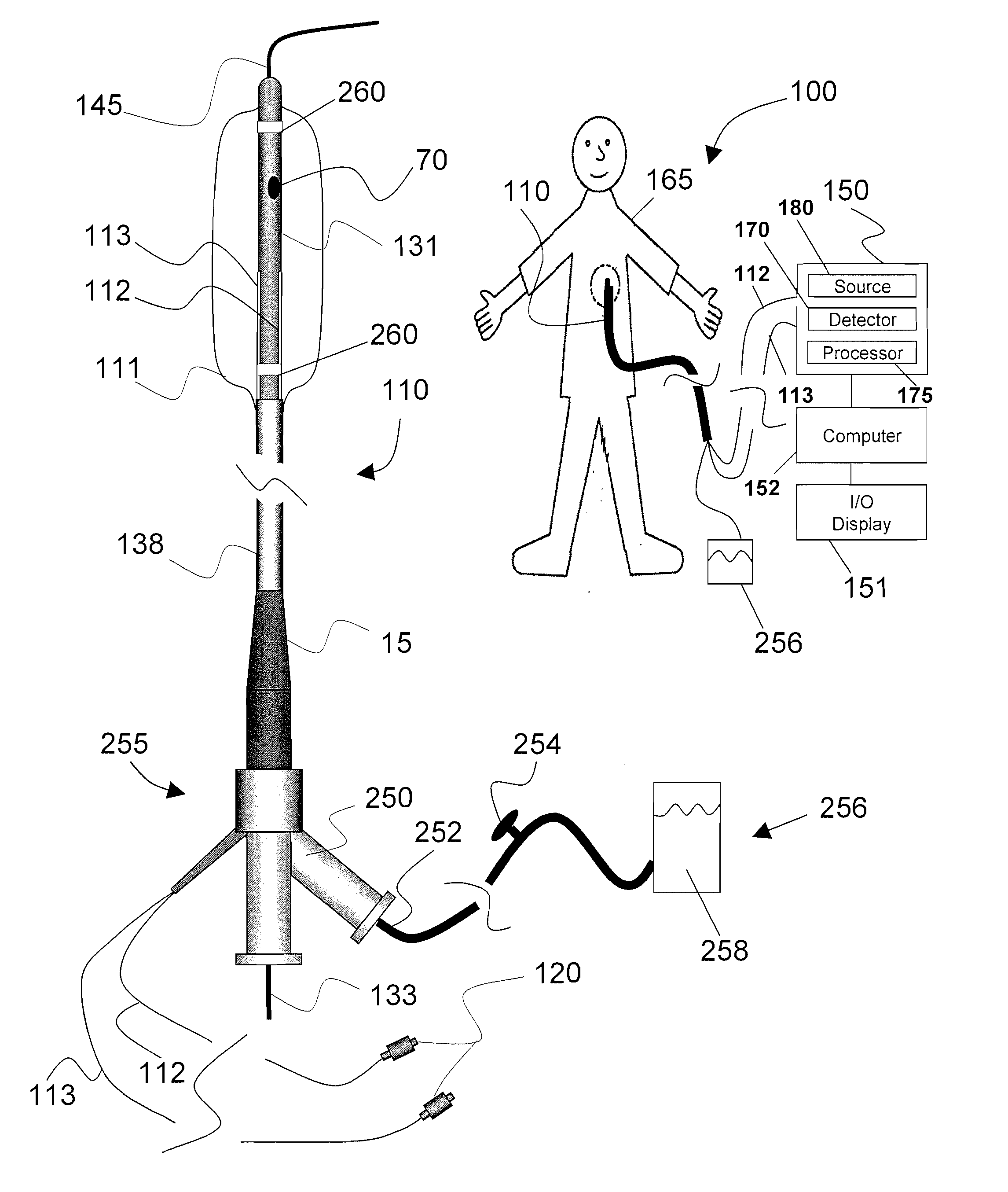 Systems and methods for analysis and treatment of a body lumen