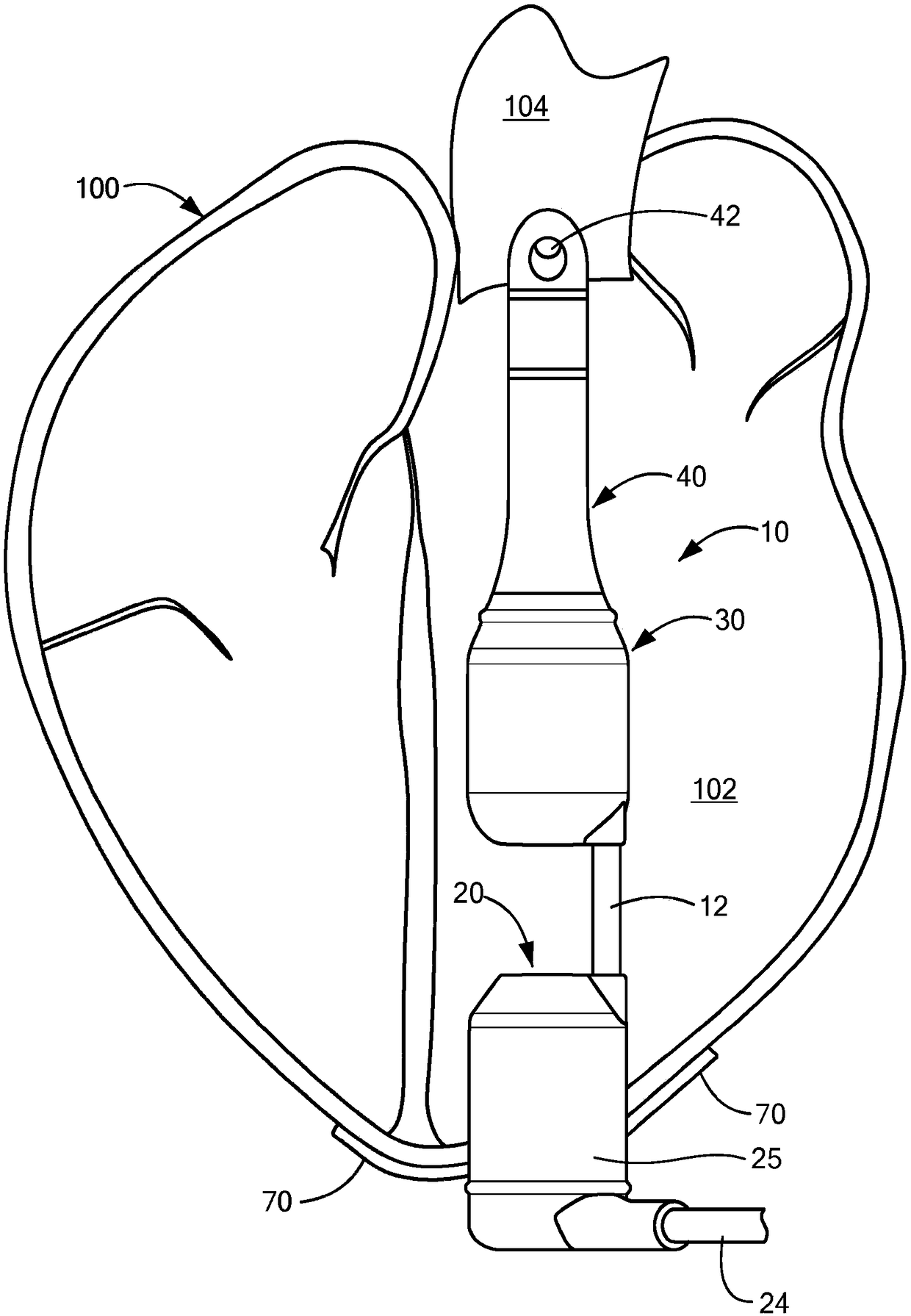 Ventricular assist devices and integrated sensors thereof