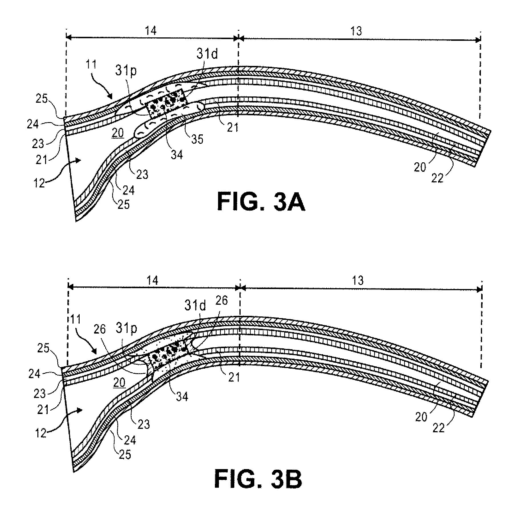 Methods and devices for occluding an ovarian pathway