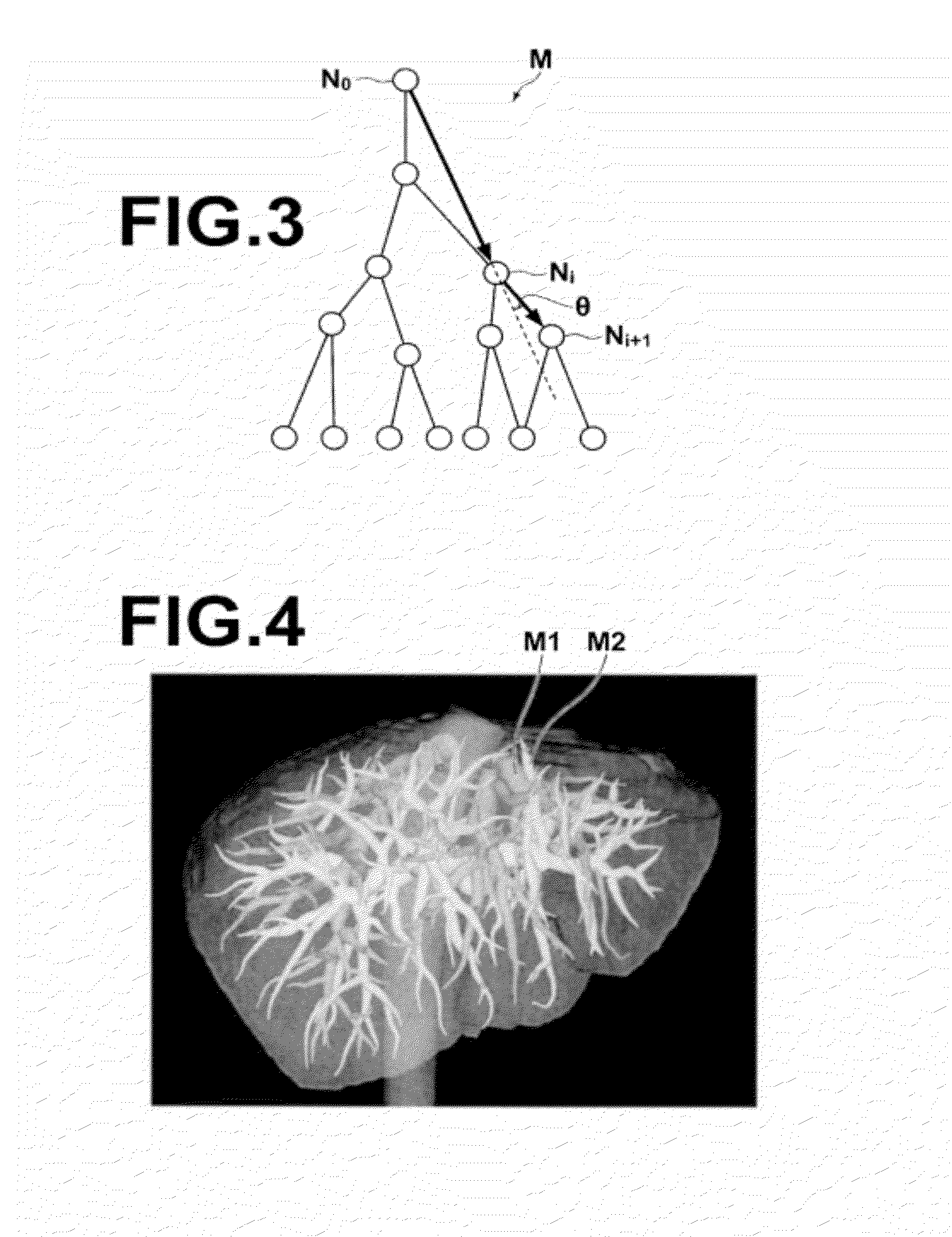 Tree structure creation apparatus, method and program