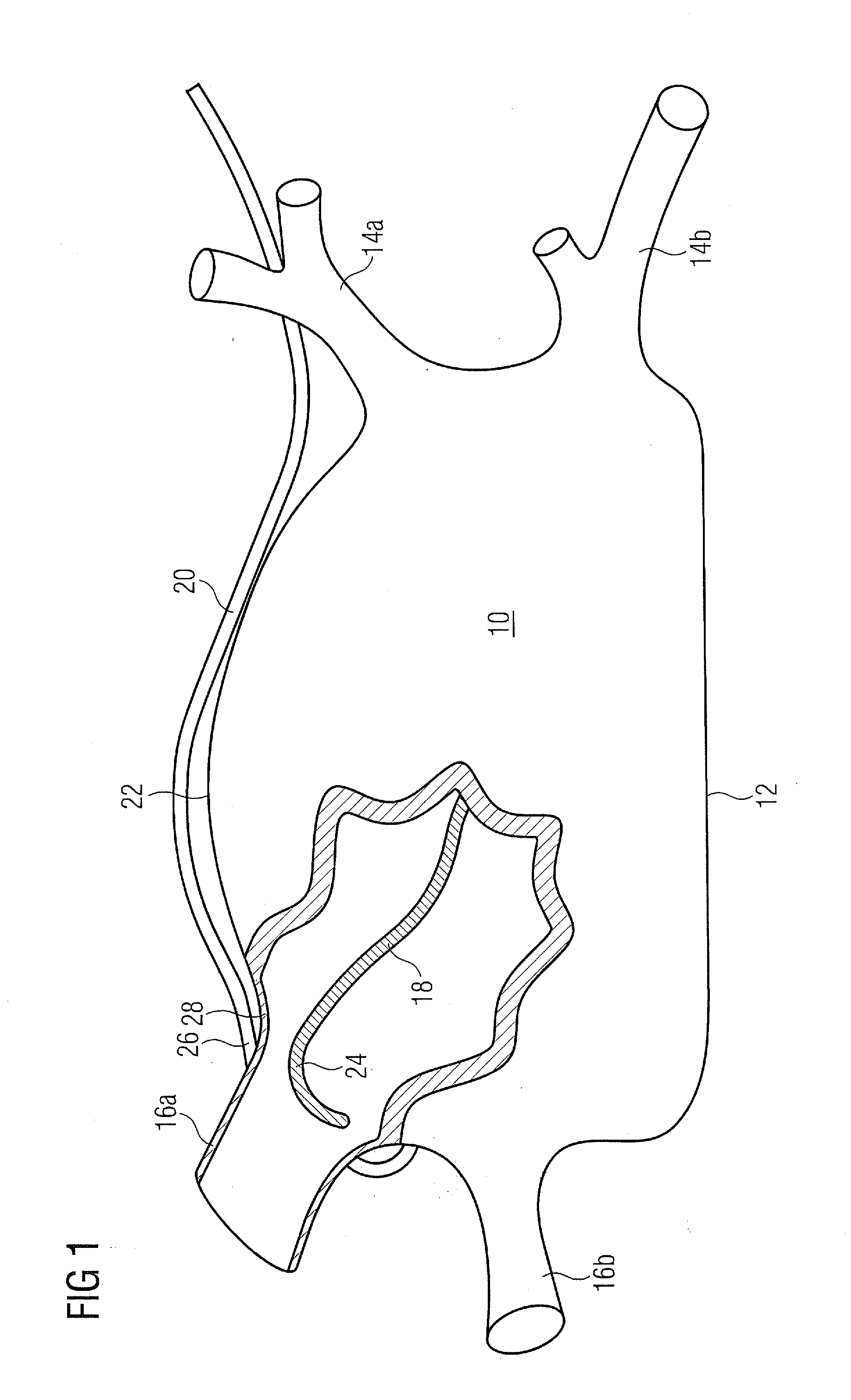 Pair of endocardial and epicardial catheters, catheter and method for positioning electrodes on a cardiac wall and method for the ablation of cardiac muscle tissue