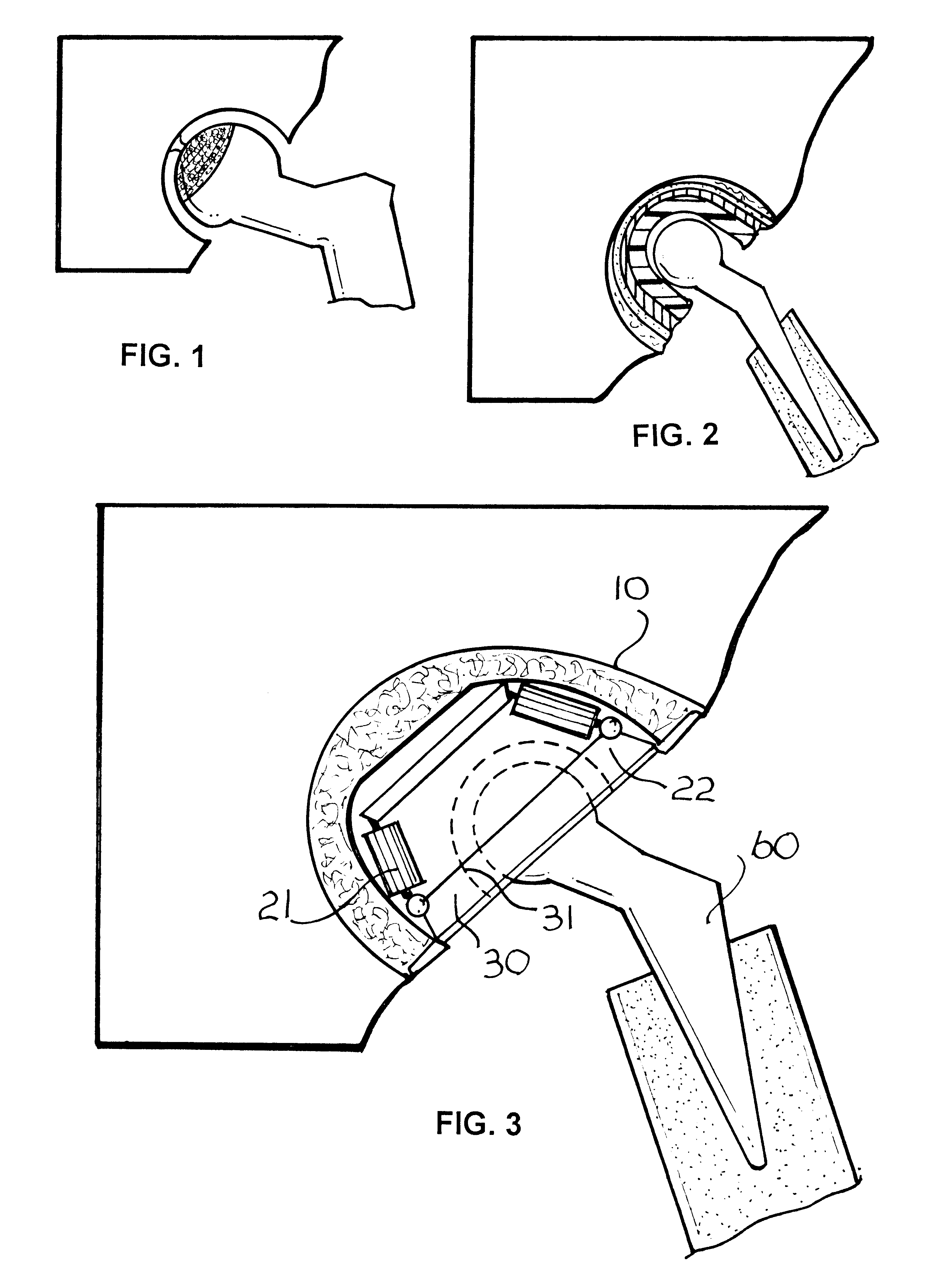 Primary axis prosthetic joint design