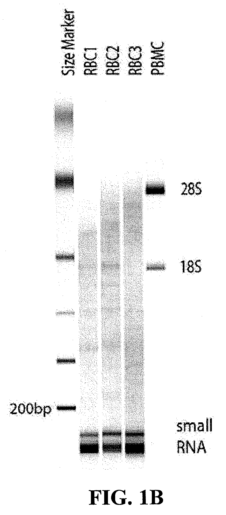 Methods and compositions for the treatment of erythrocyte diseases