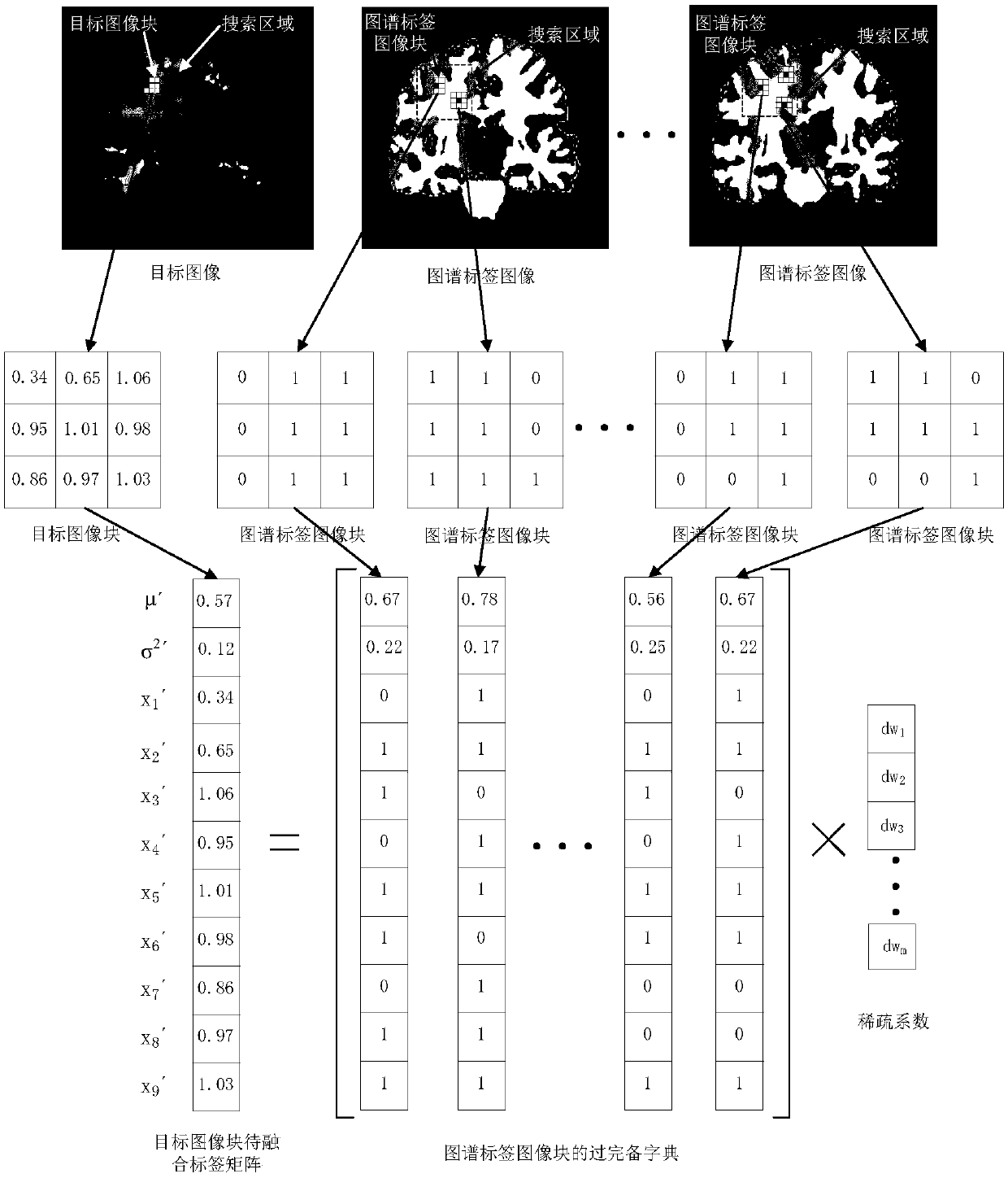 An automatic medical image segmentation method based on multi-atlas label fusion