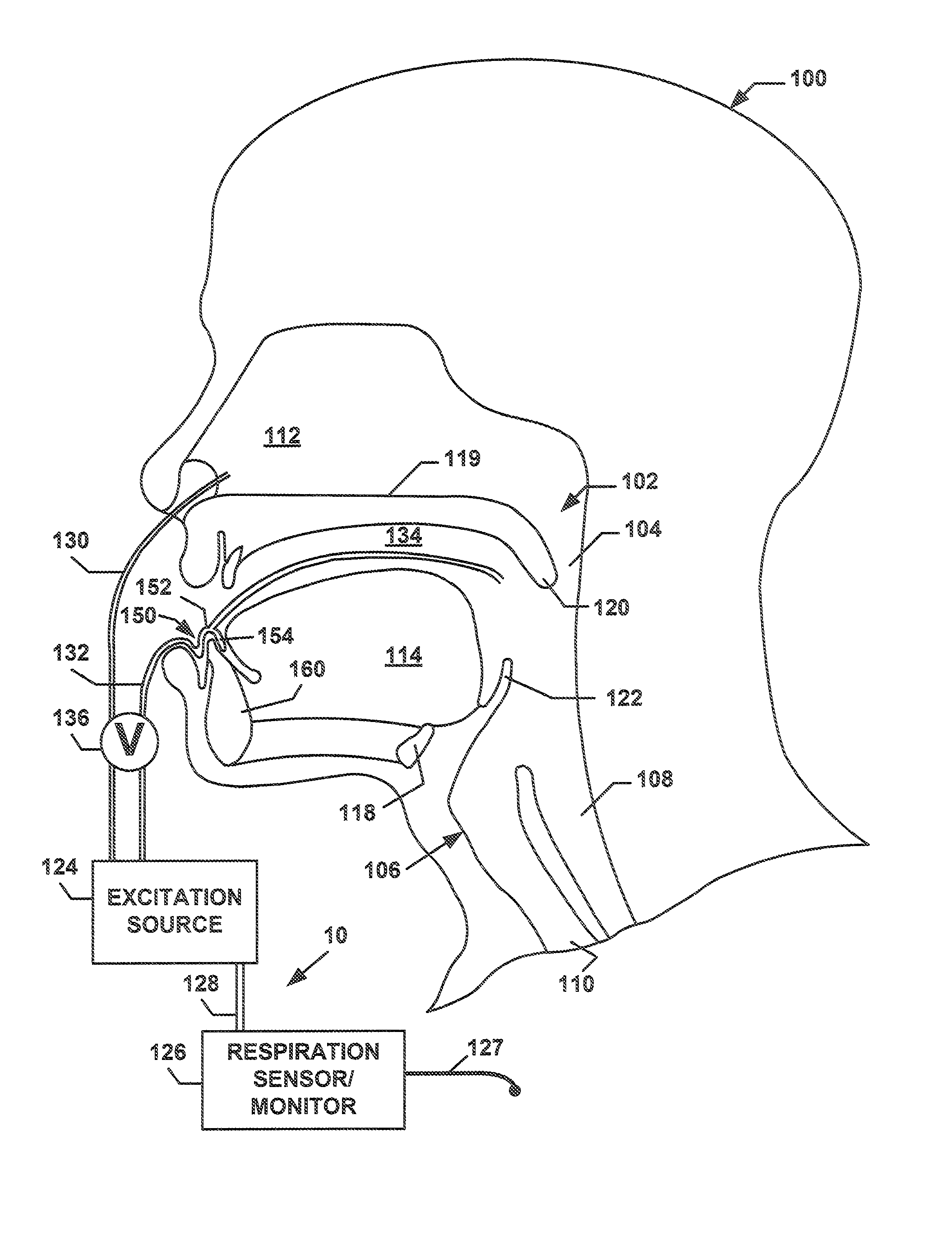 Discontinuous Positive Airway Pressure Device And Method Of Reducing Sleep Disordered Breathing Events
